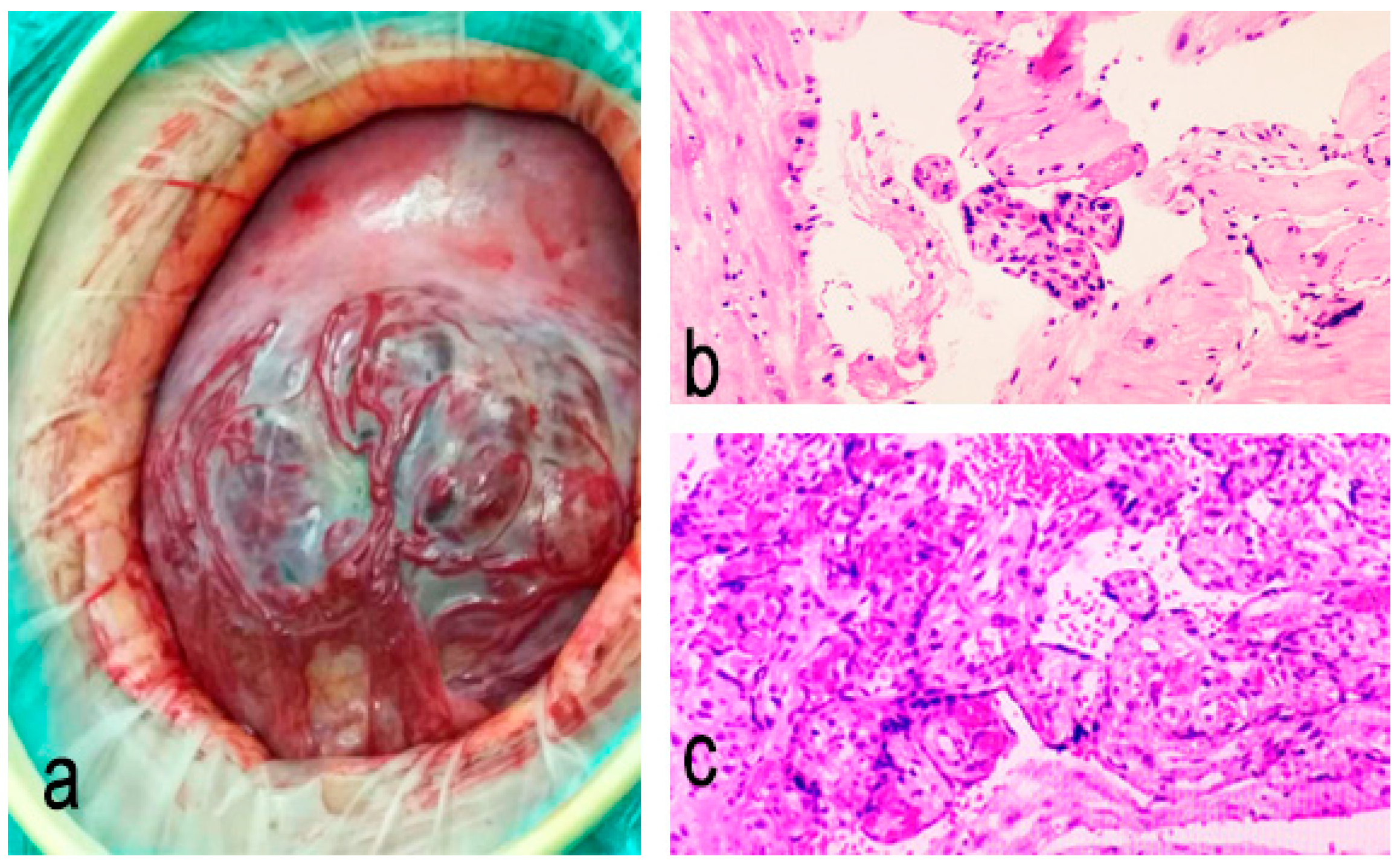 Medicina 61 00392 g001