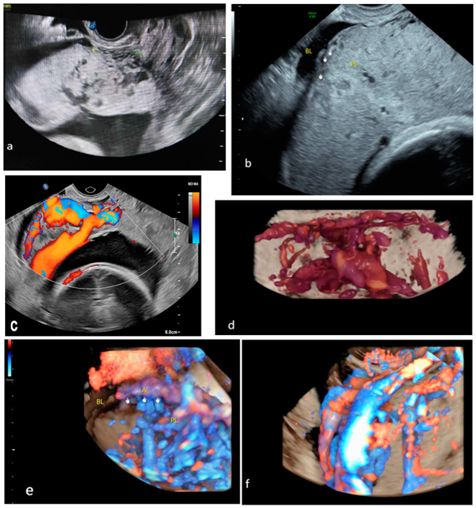 Medicina 61 00392 g002