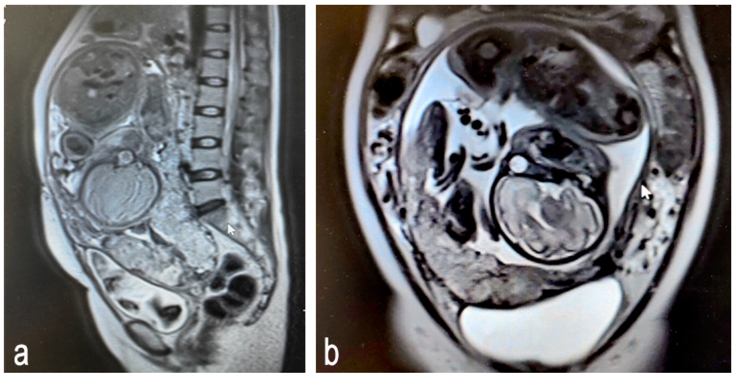 Medicina 61 00392 g003