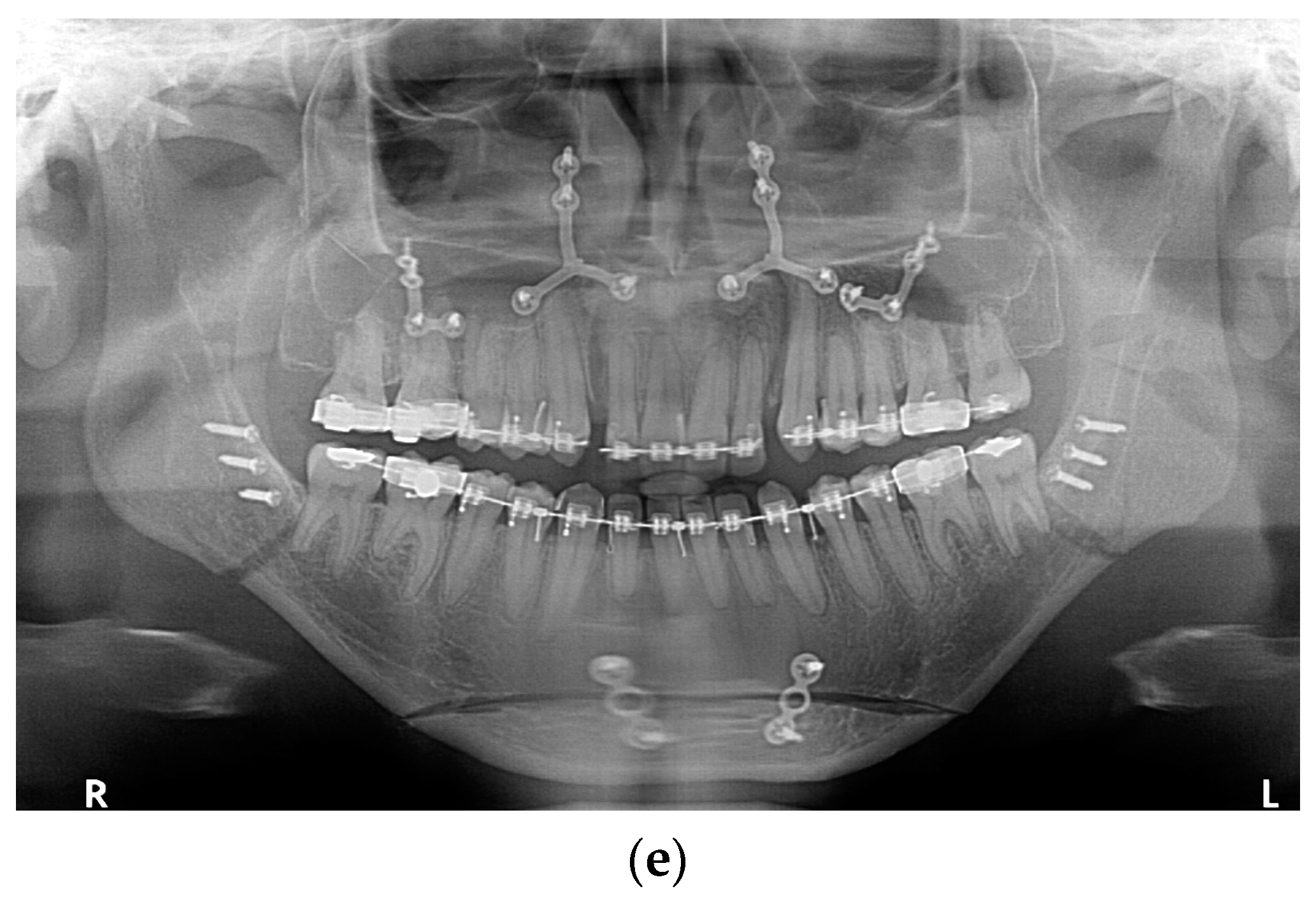 Medicina 61 00403 g001b