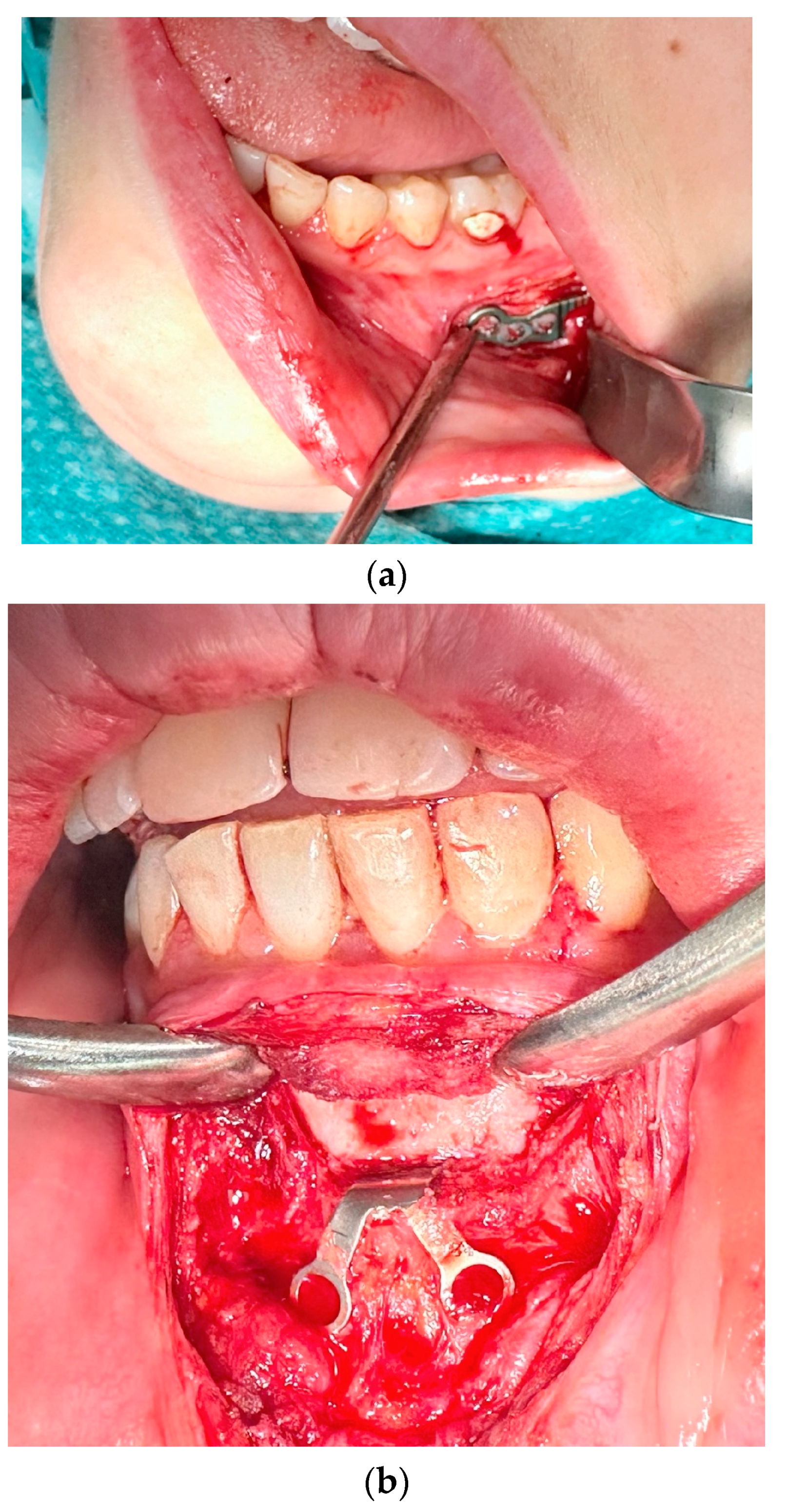 Medicina 61 00403 g005a
