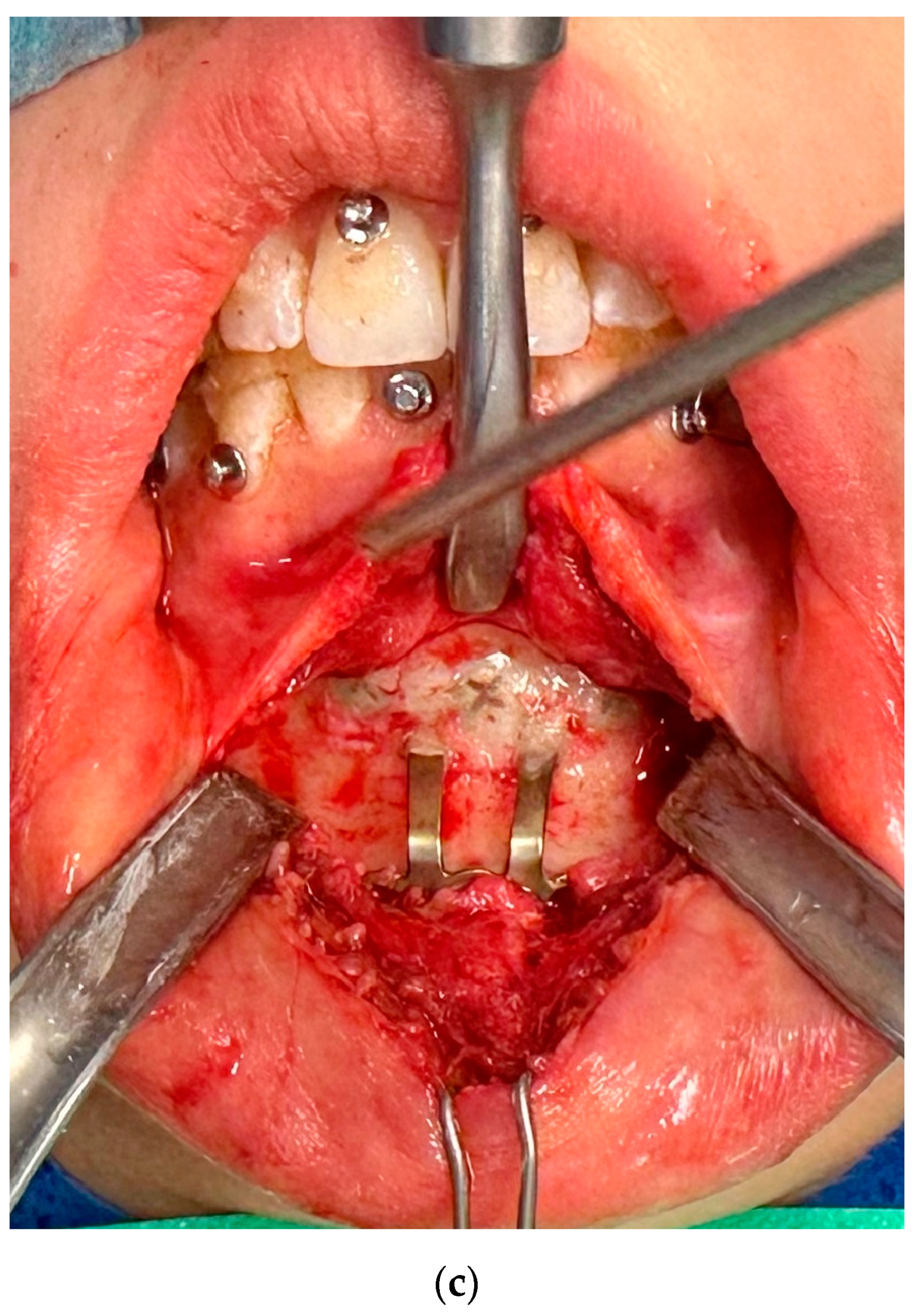 Medicina 61 00403 g005b