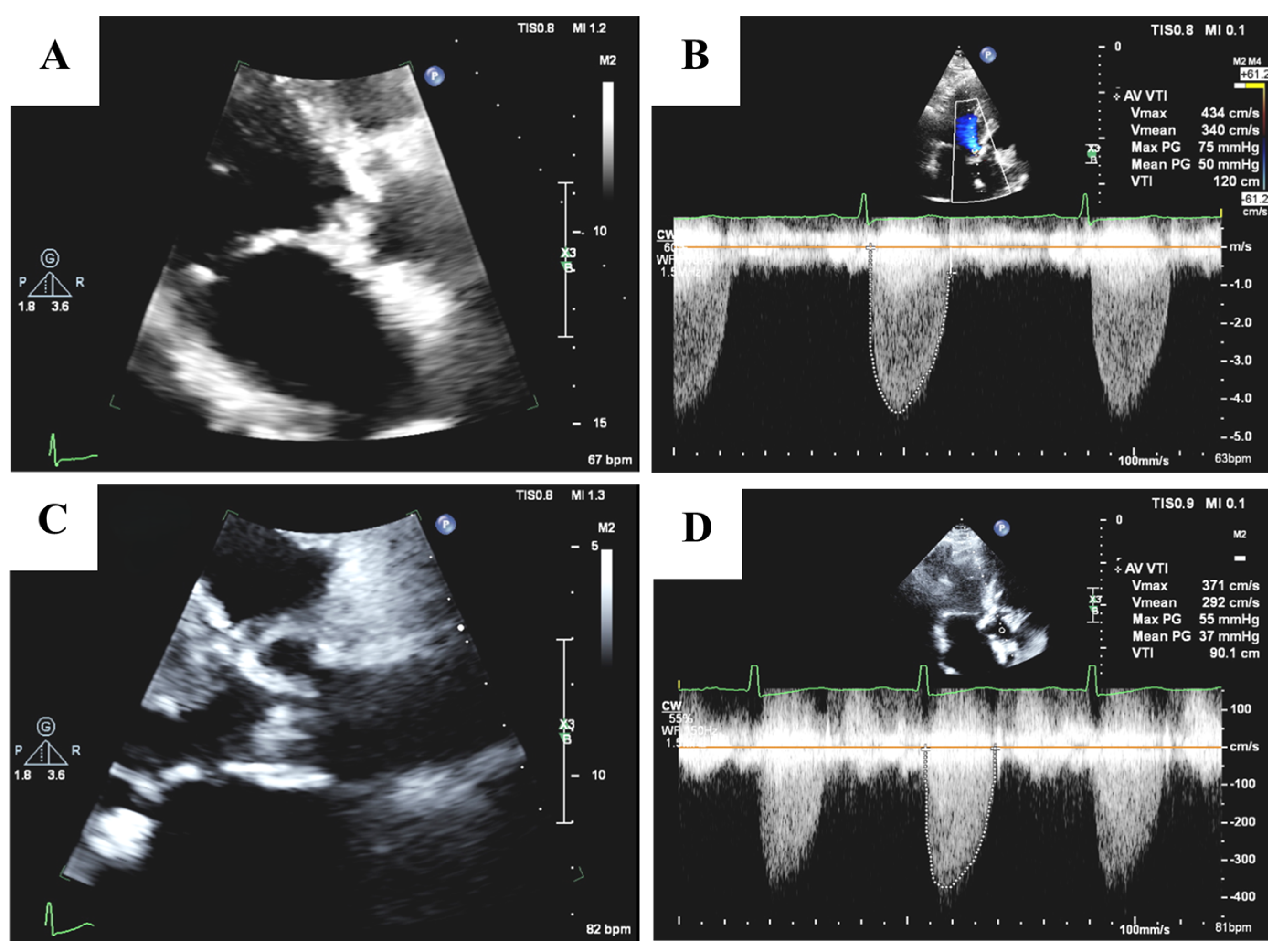 Medicina 61 00448 g002