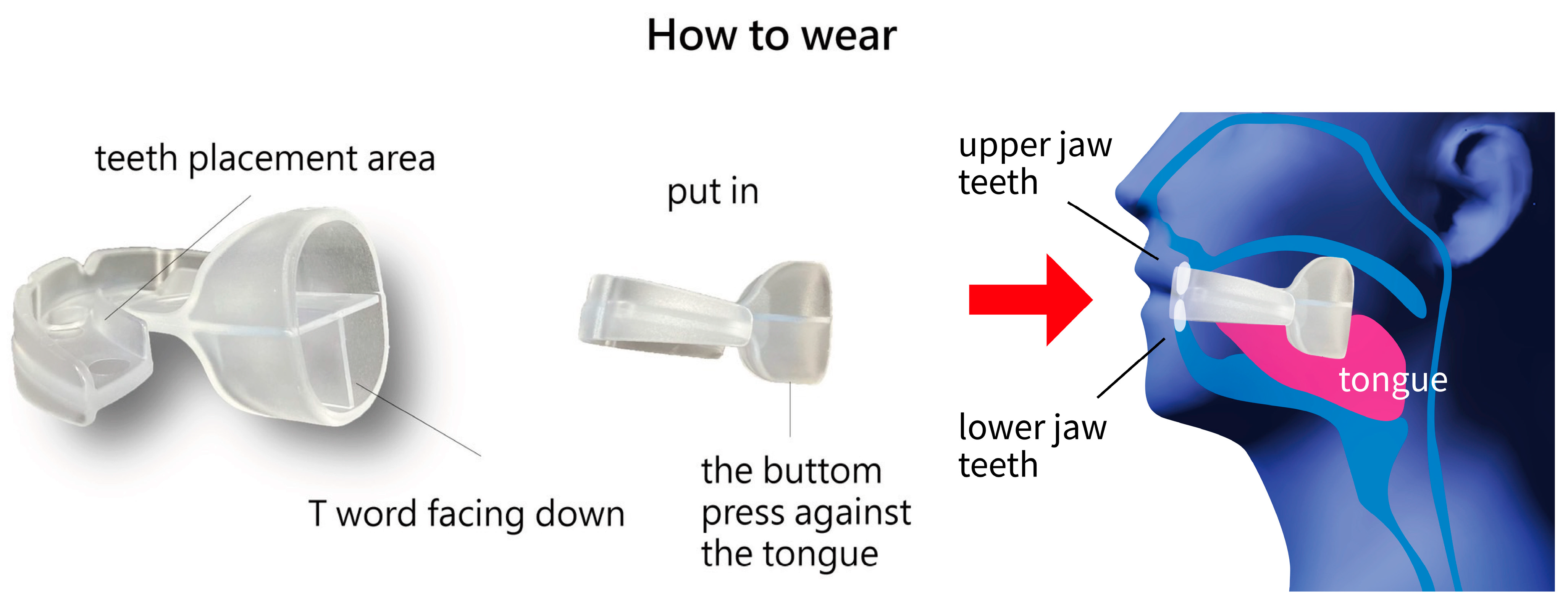 Medicina 61 00511 g002