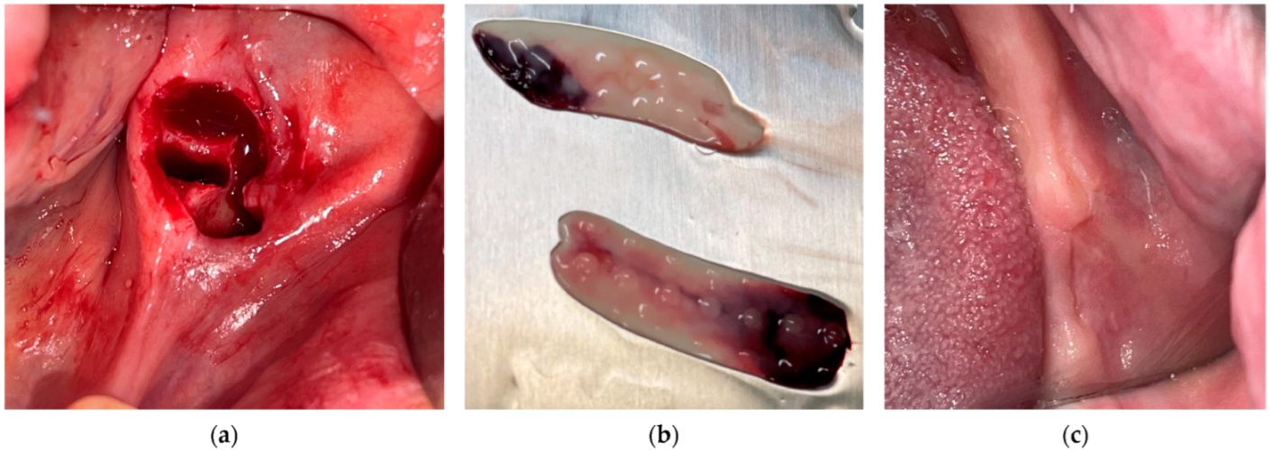 Medicina 61 00625 g001