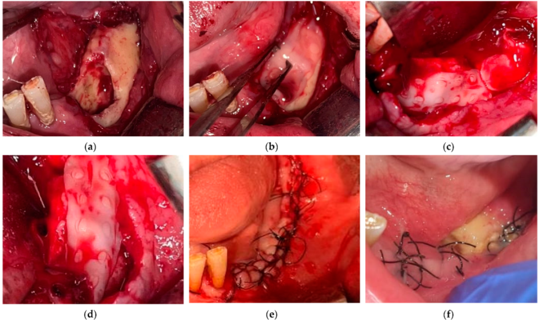 Medicina 61 00625 g003