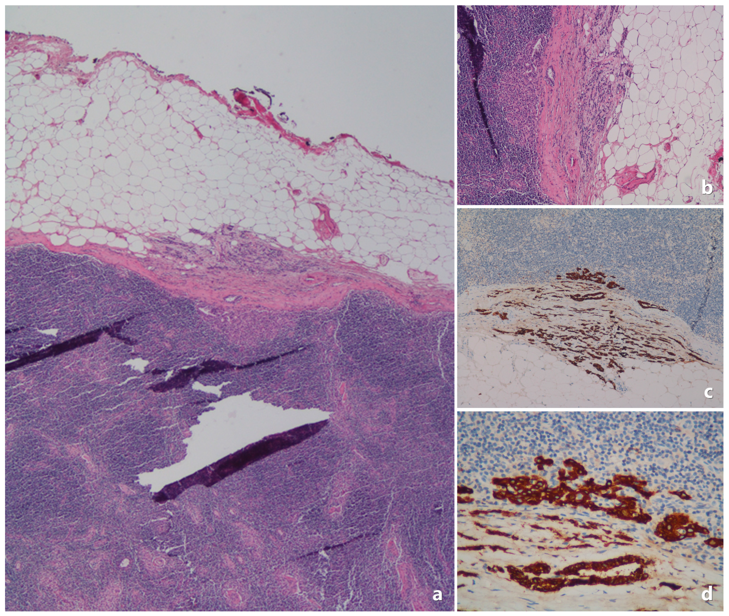 Medicina 61 00710 g004