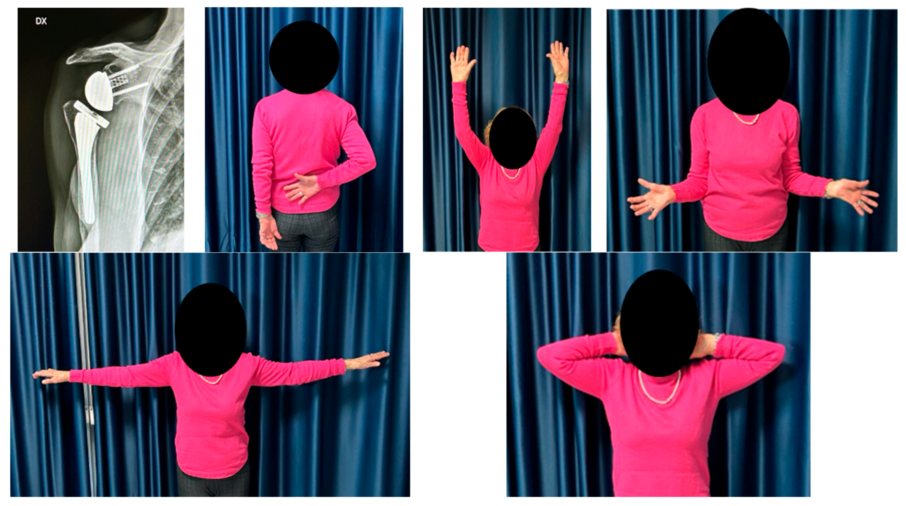 Medicina 61 00749 g004