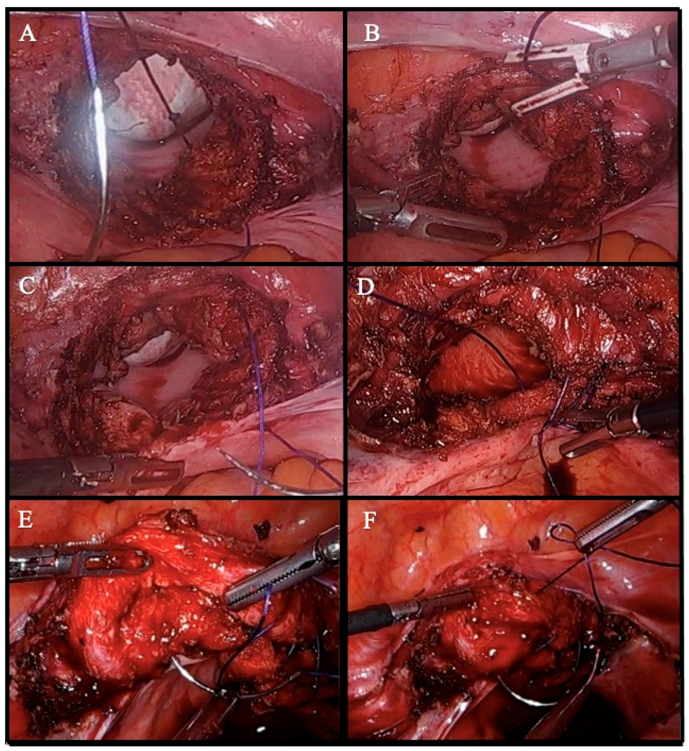 Medicina 61 00813 g002