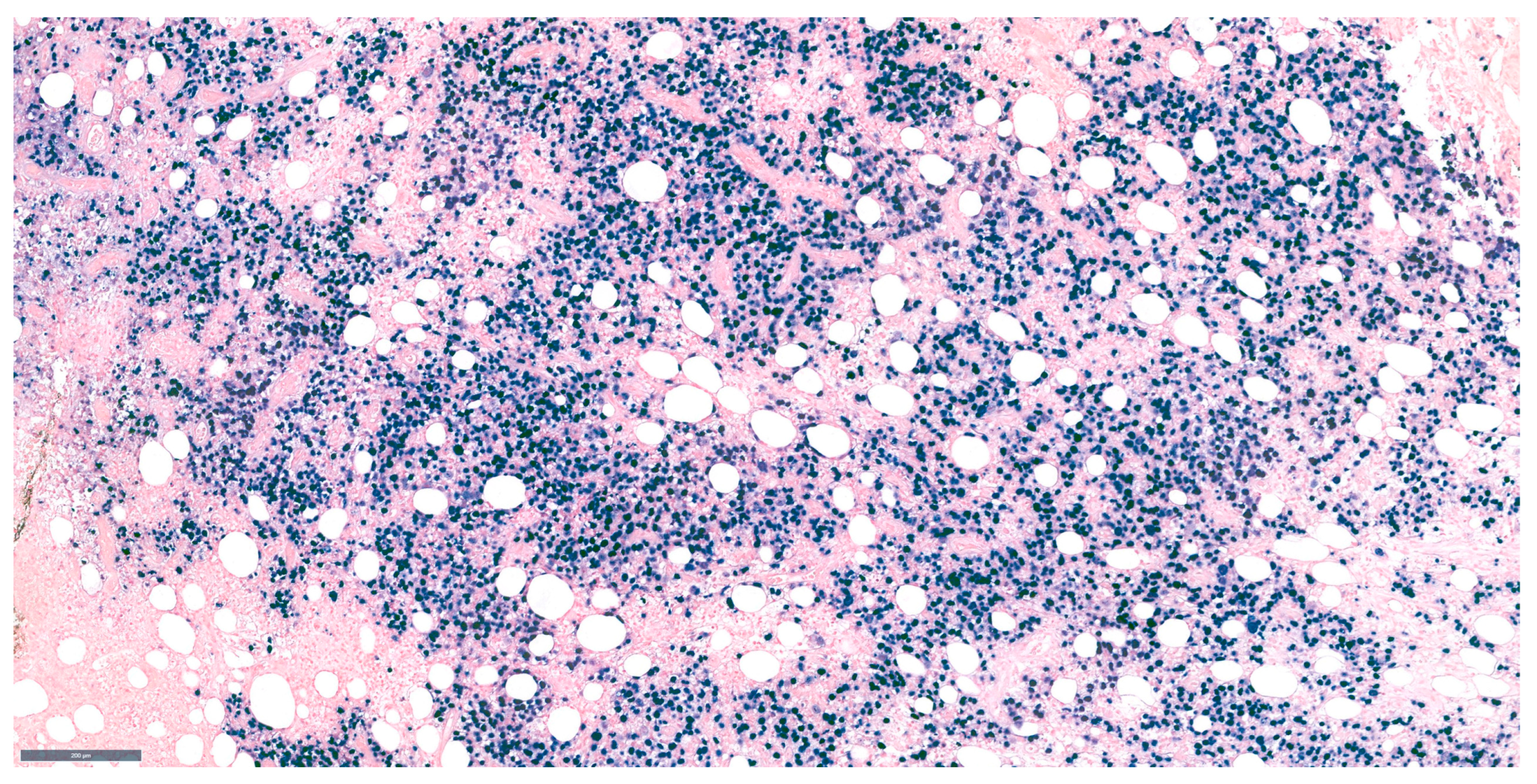 Medicina 61 00842 g004