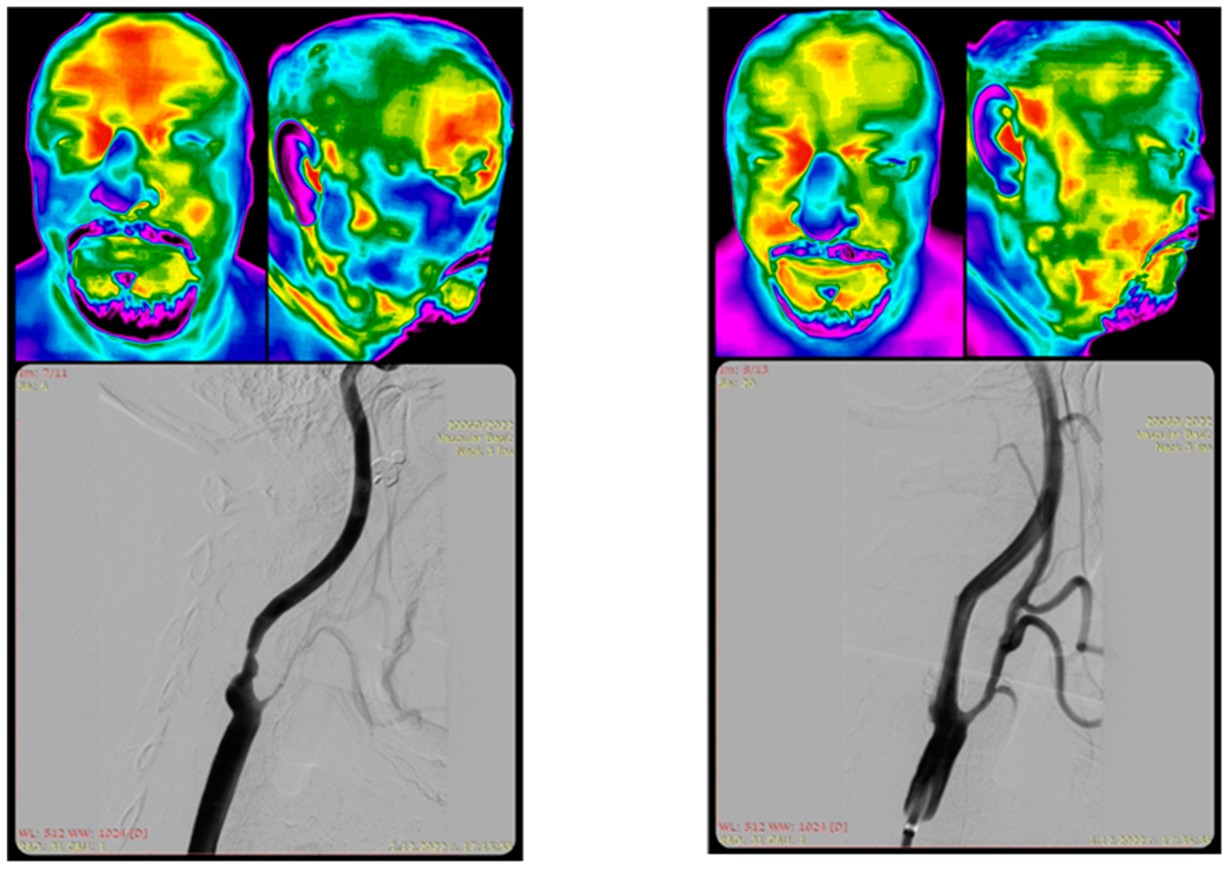 Medicina 61 00854 g001