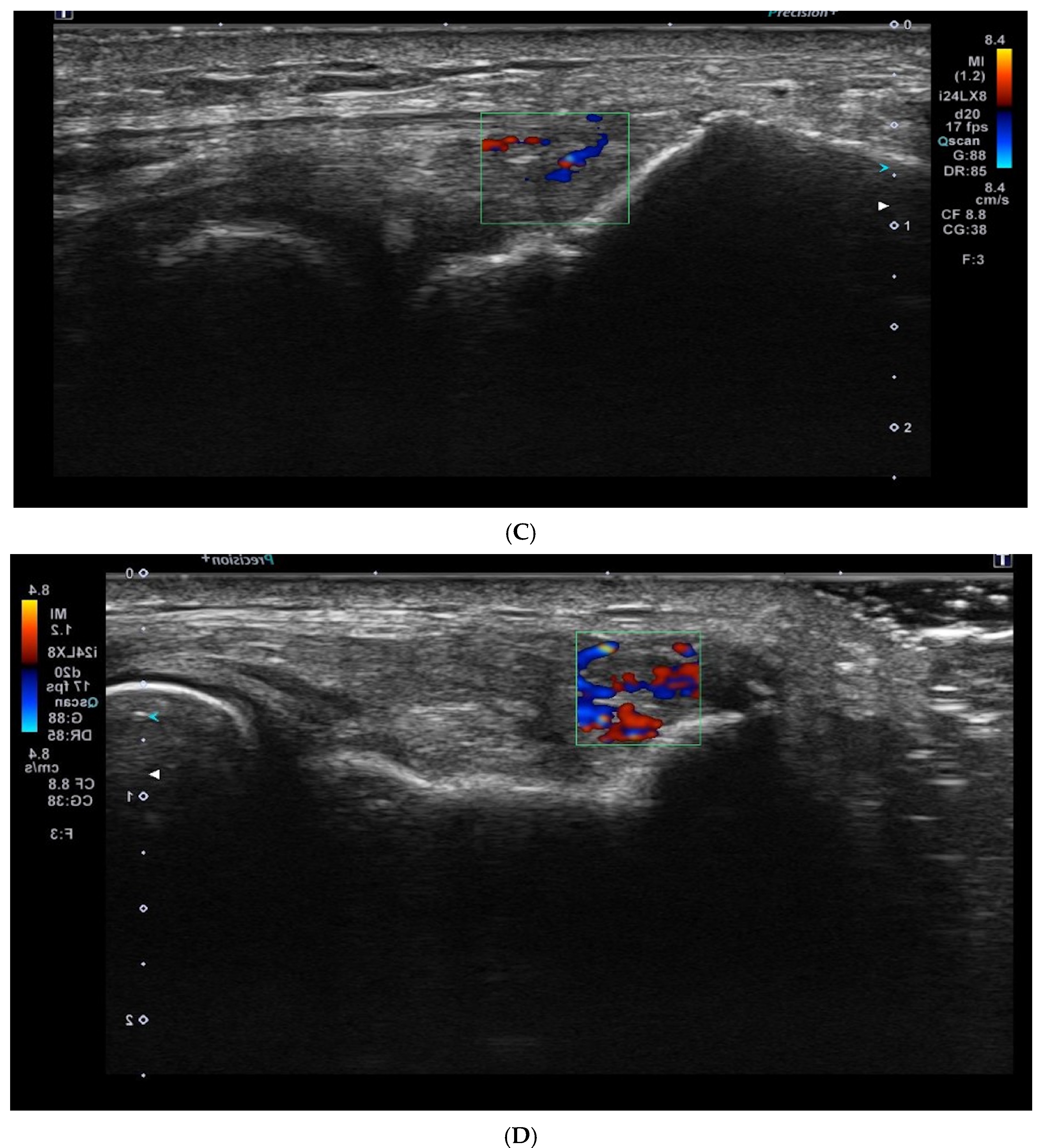 Medicina 61 00894 g002b