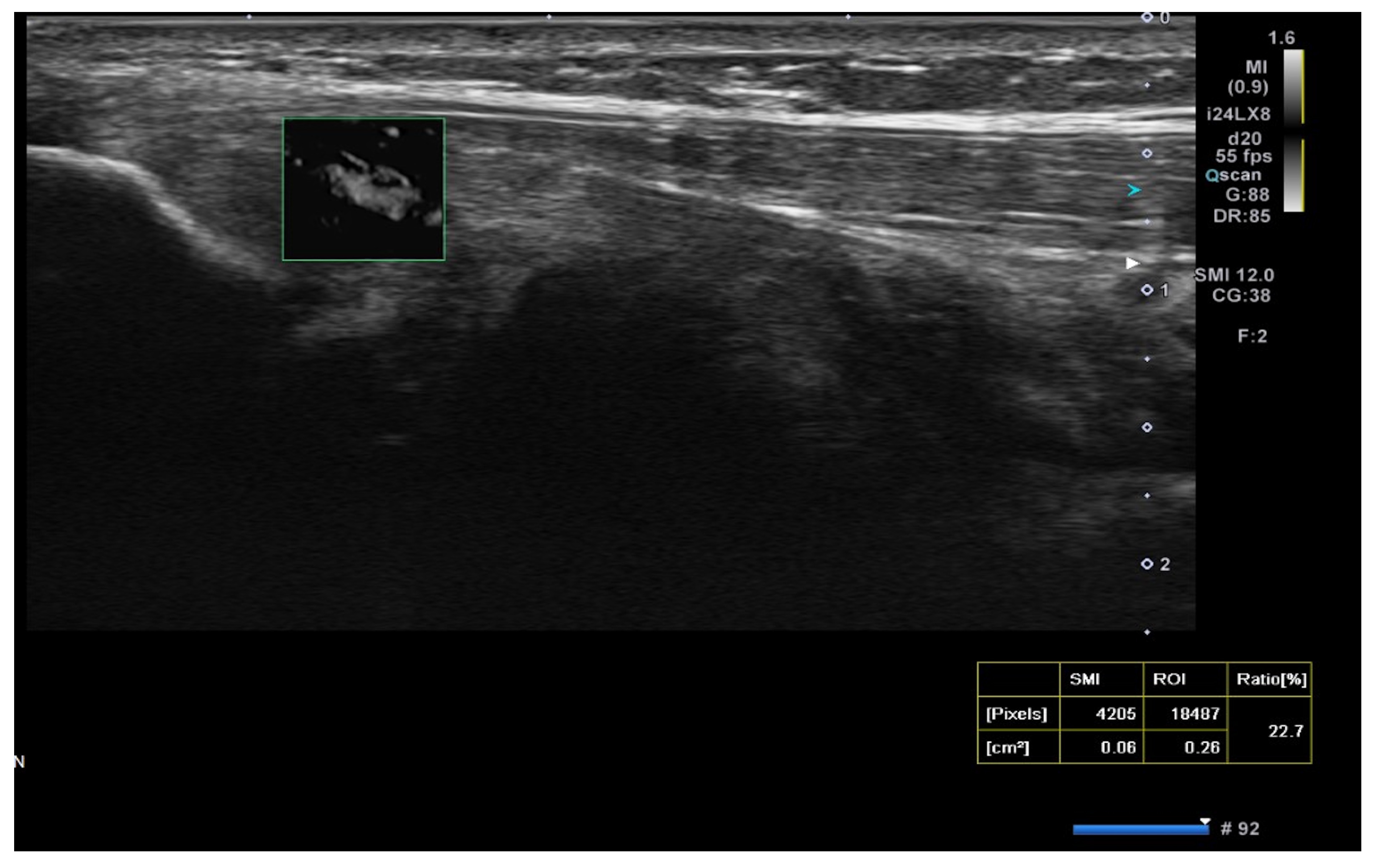 Medicina 61 00894 g003