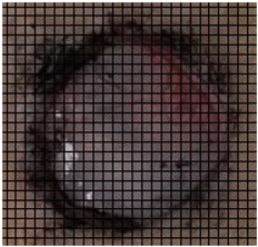 Medicina 61 00965 i001