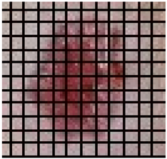 Medicina 61 00965 i005