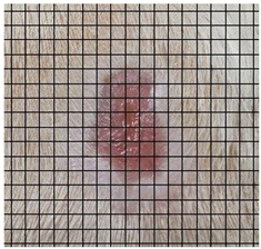 Medicina 61 00965 i007