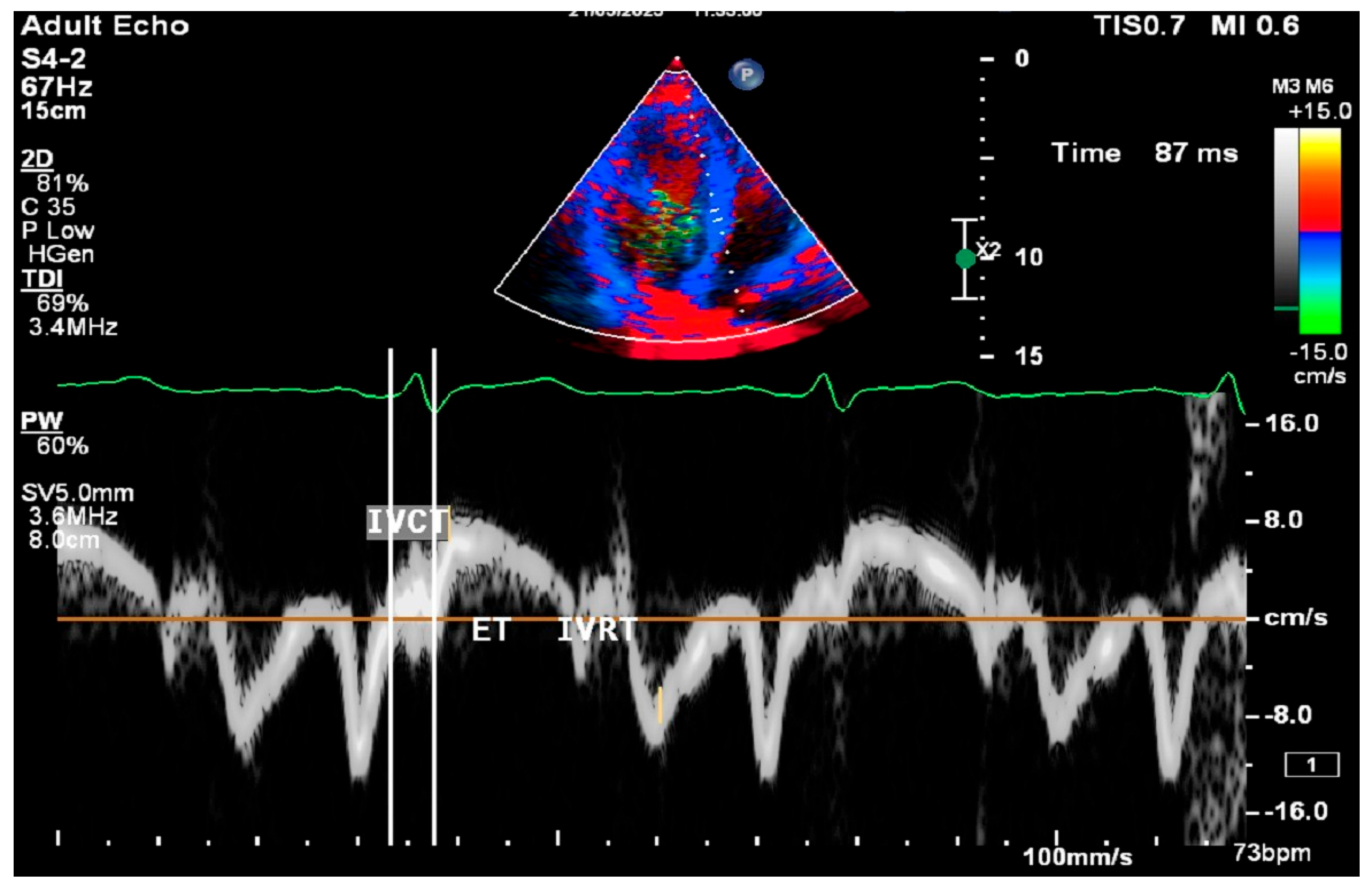 Medicina 61 00987 g002
