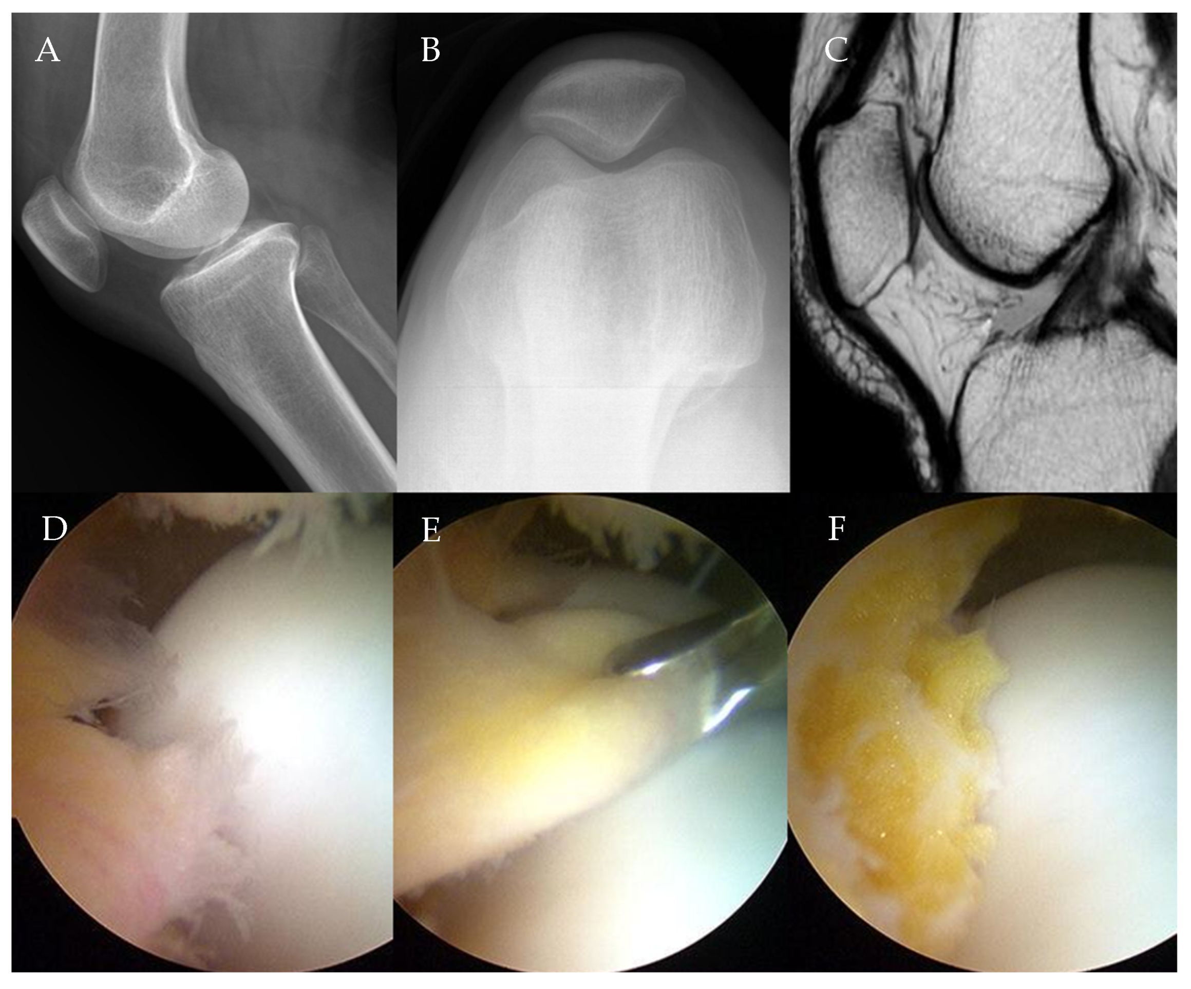 Medicina 61 00997 g001