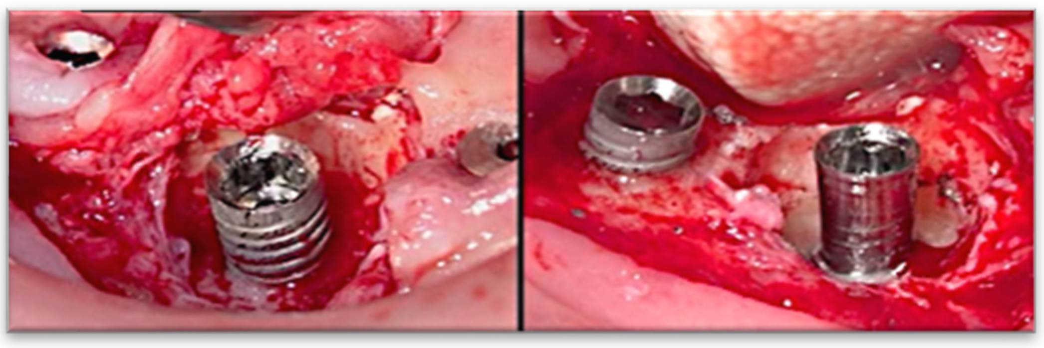 Medicina 61 01094 g003