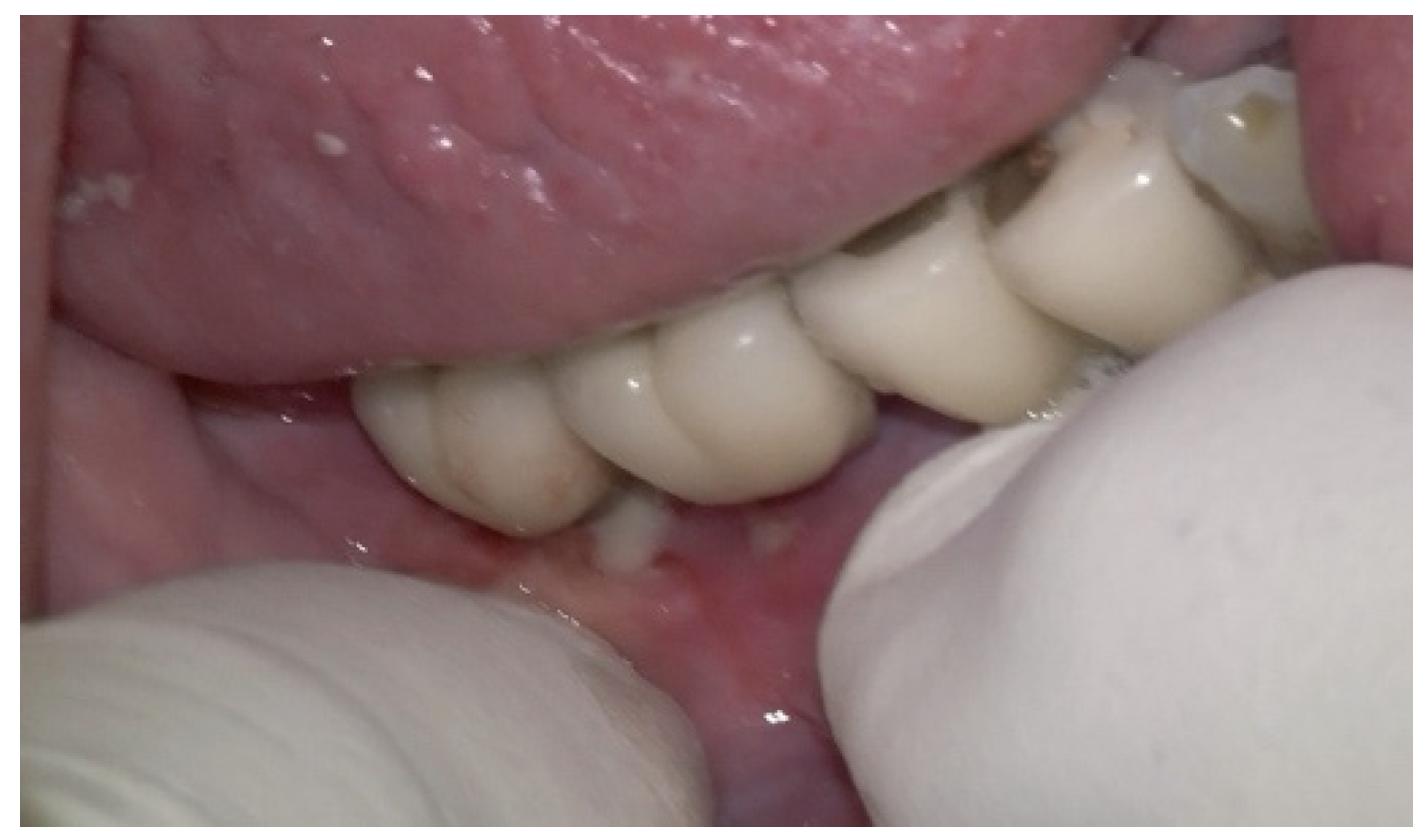 Medicina 61 01094 g006