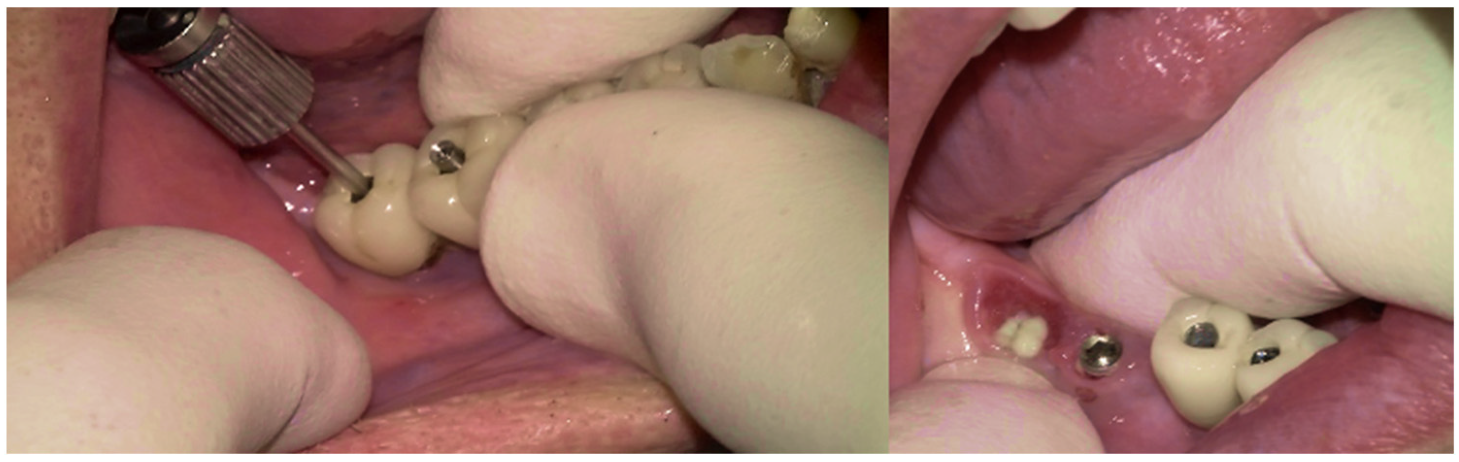 Medicina 61 01094 g009