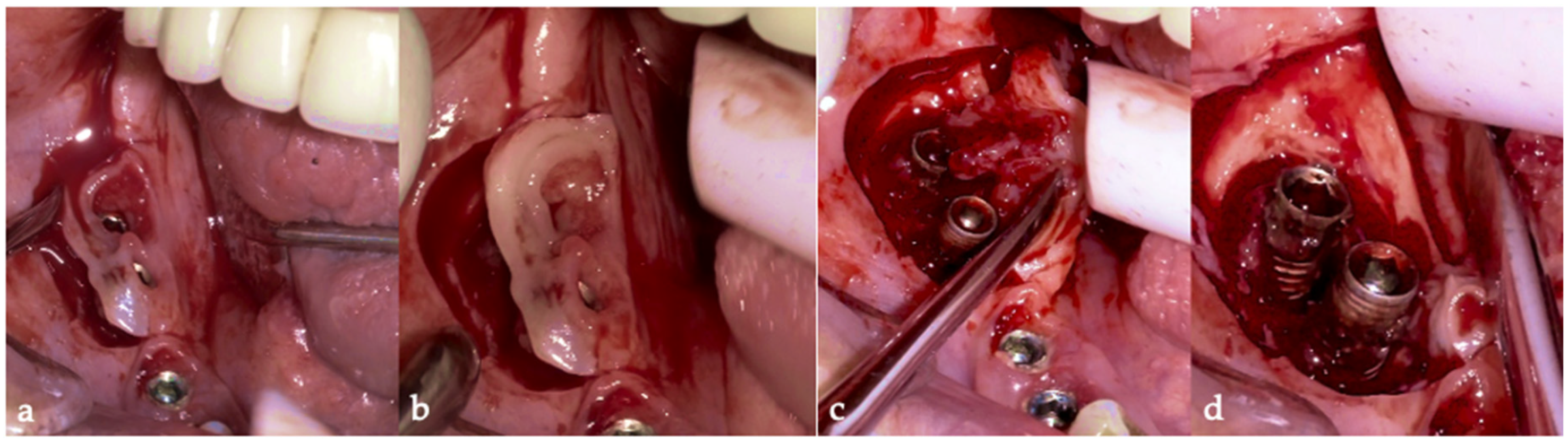 Medicina 61 01094 g010