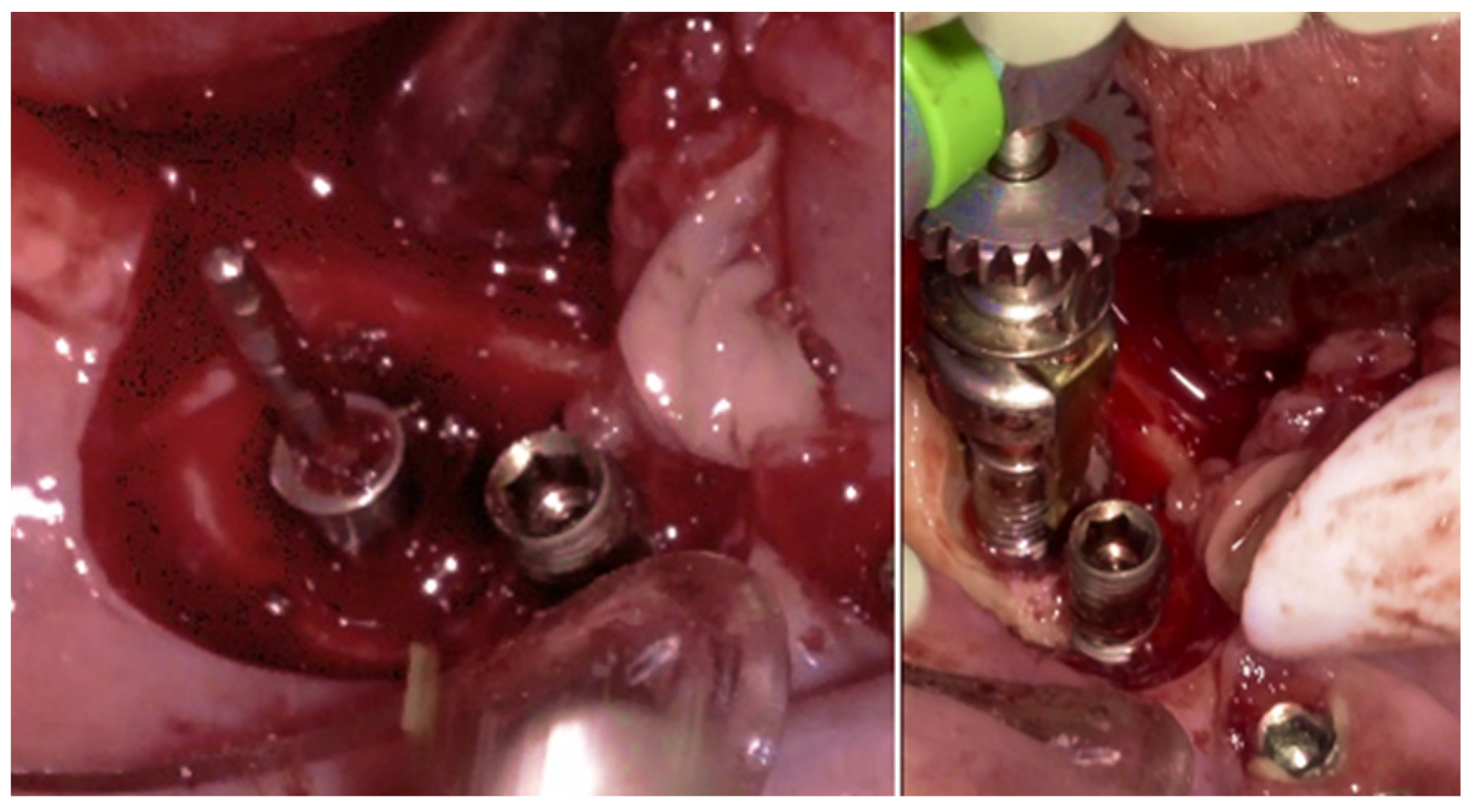 Medicina 61 01094 g011