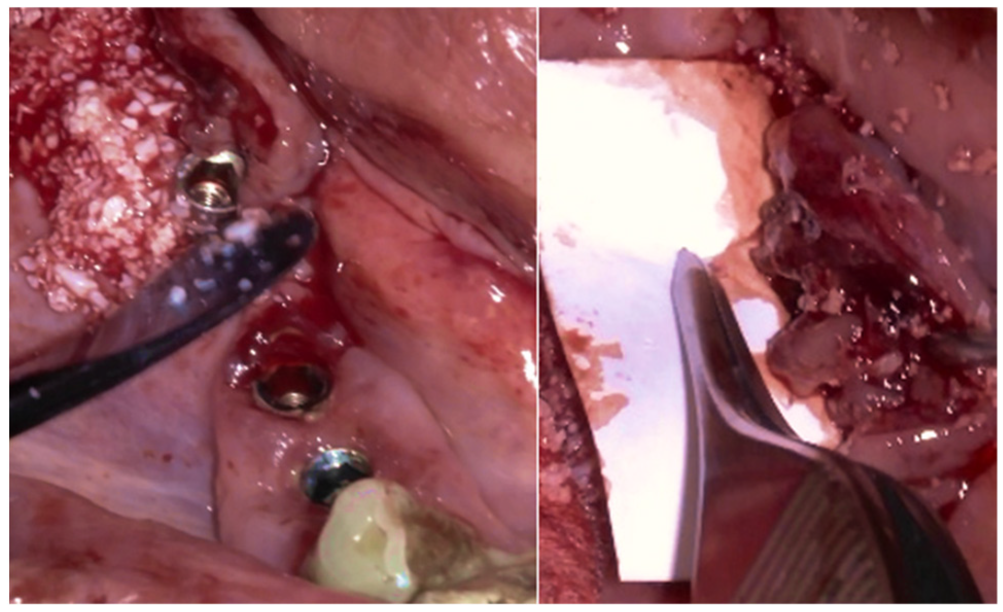 Medicina 61 01094 g012