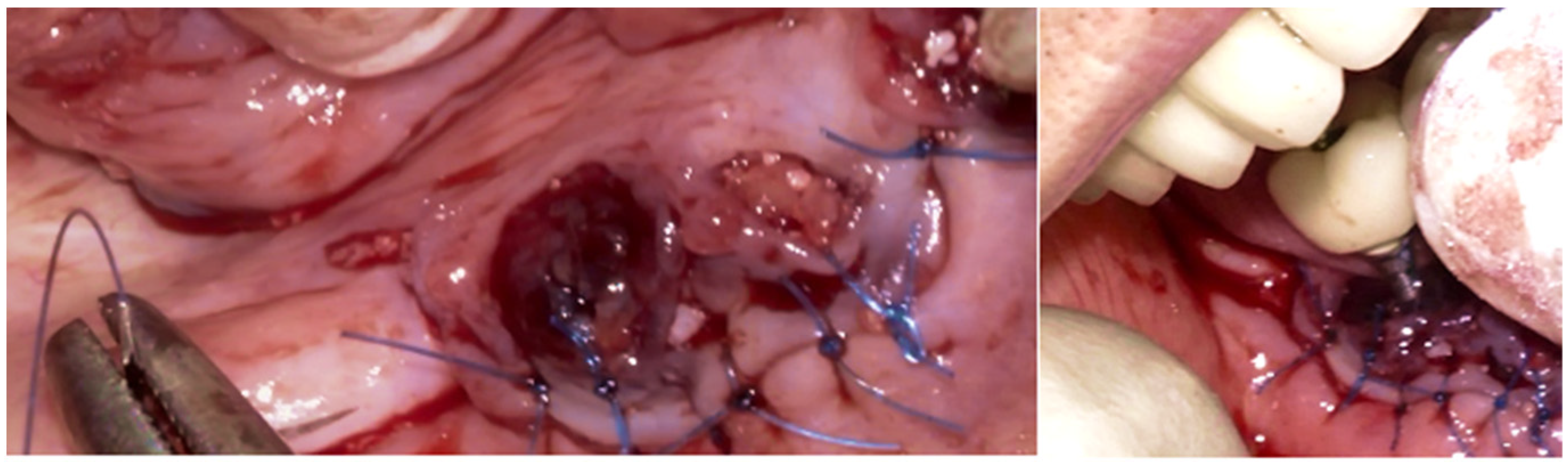 Medicina 61 01094 g013