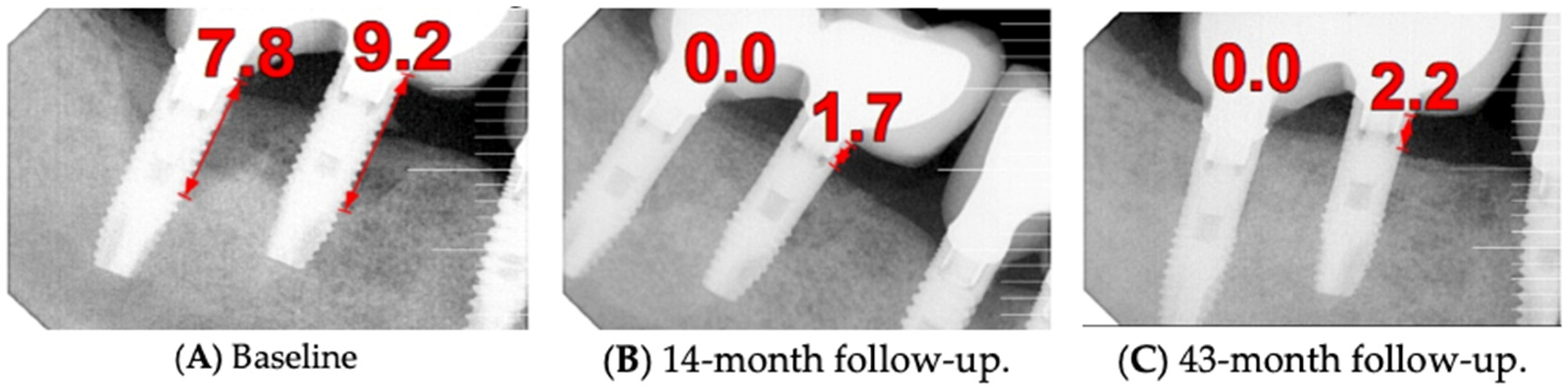 Medicina 61 01094 g014