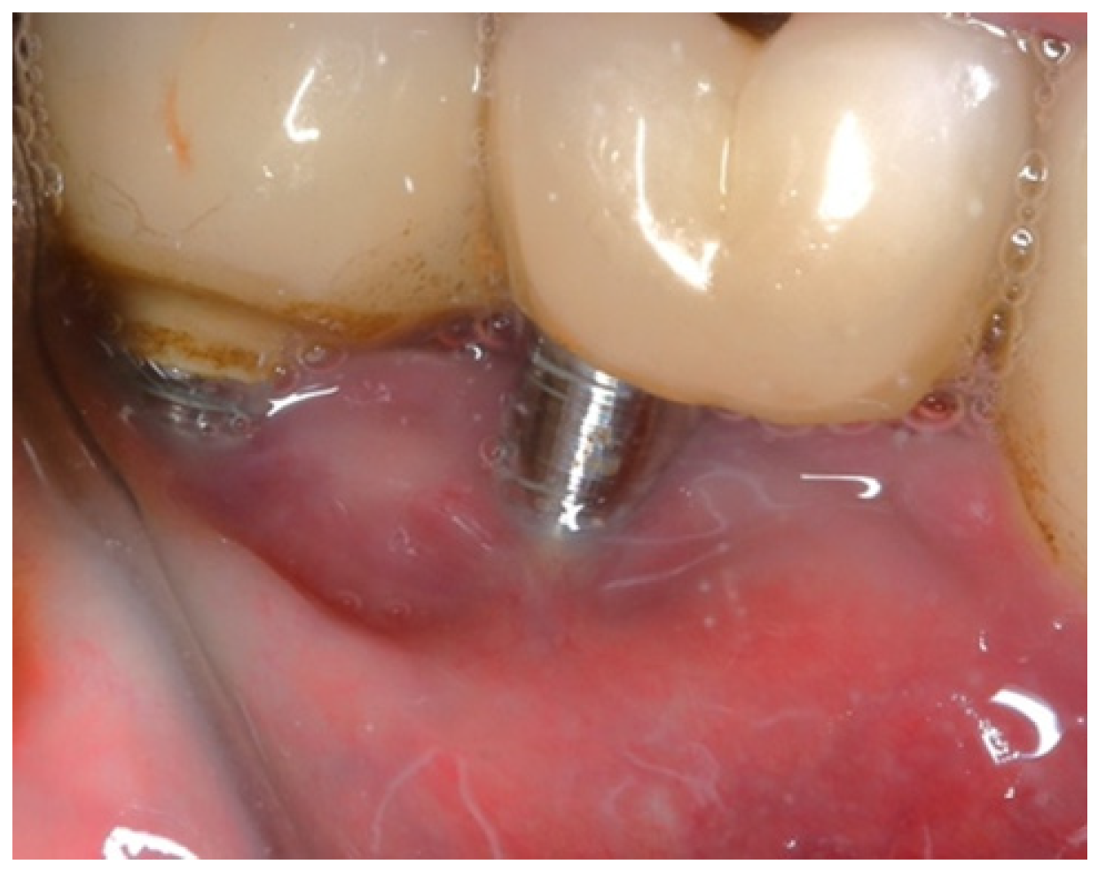 Medicina 61 01094 g015