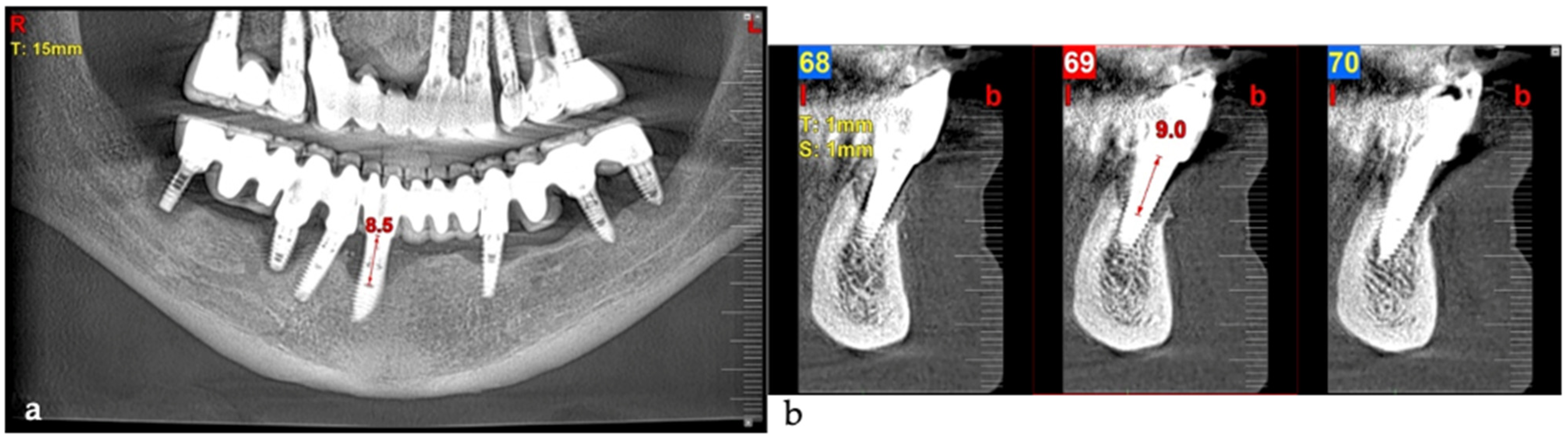 Medicina 61 01094 g016