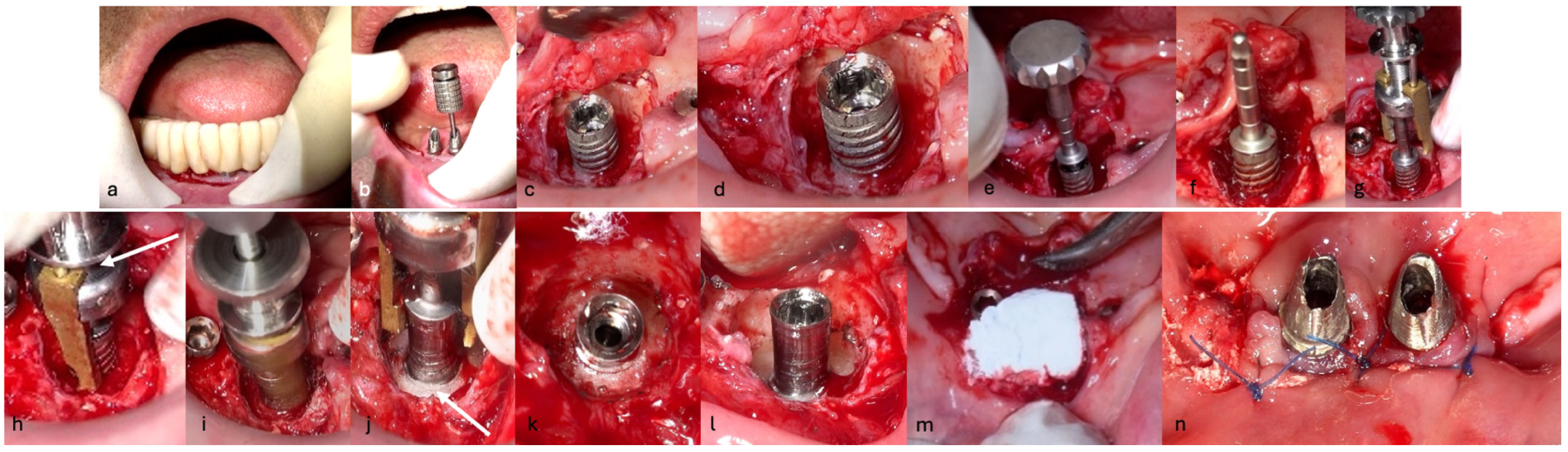 Medicina 61 01094 g017