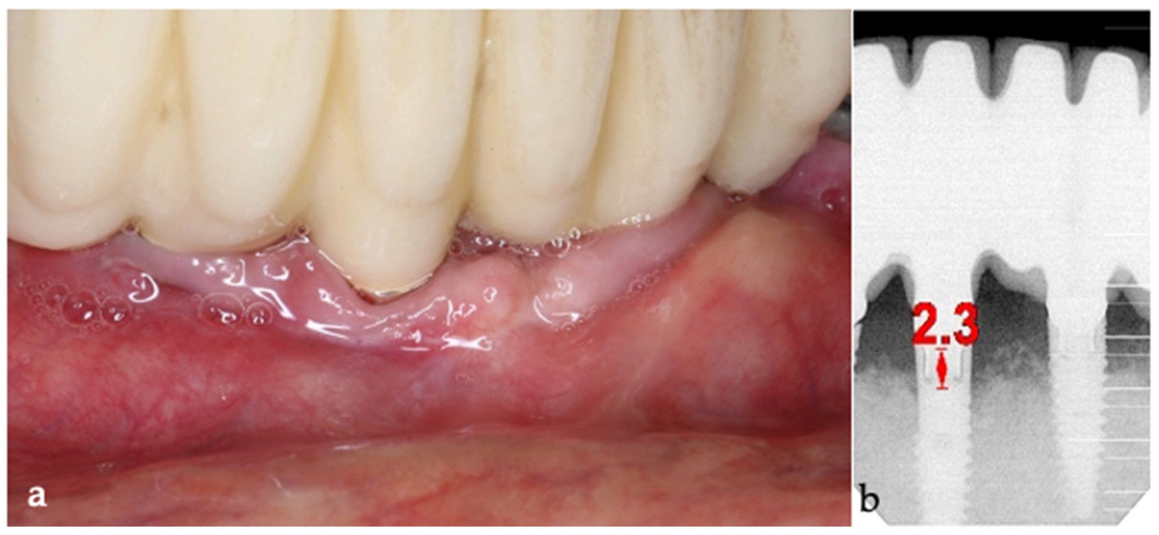 Medicina 61 01094 g018