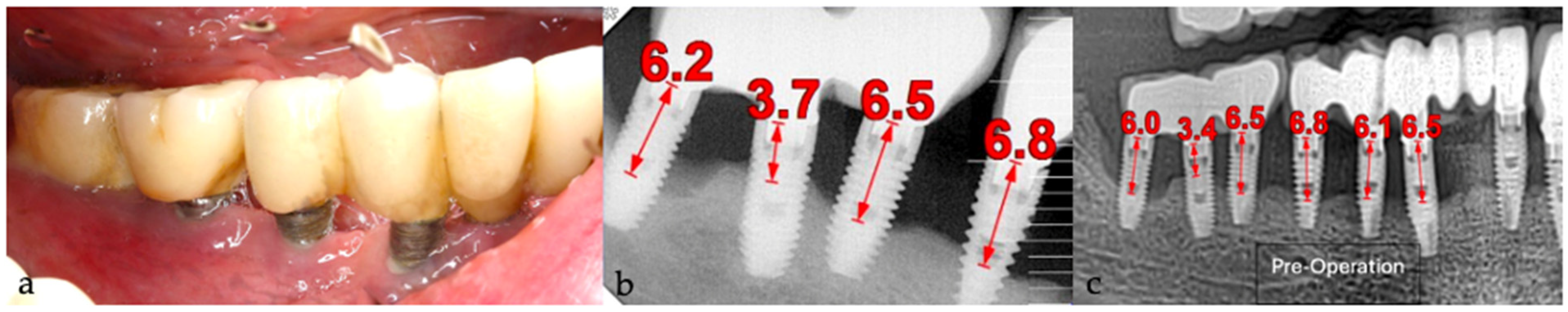 Medicina 61 01094 g019