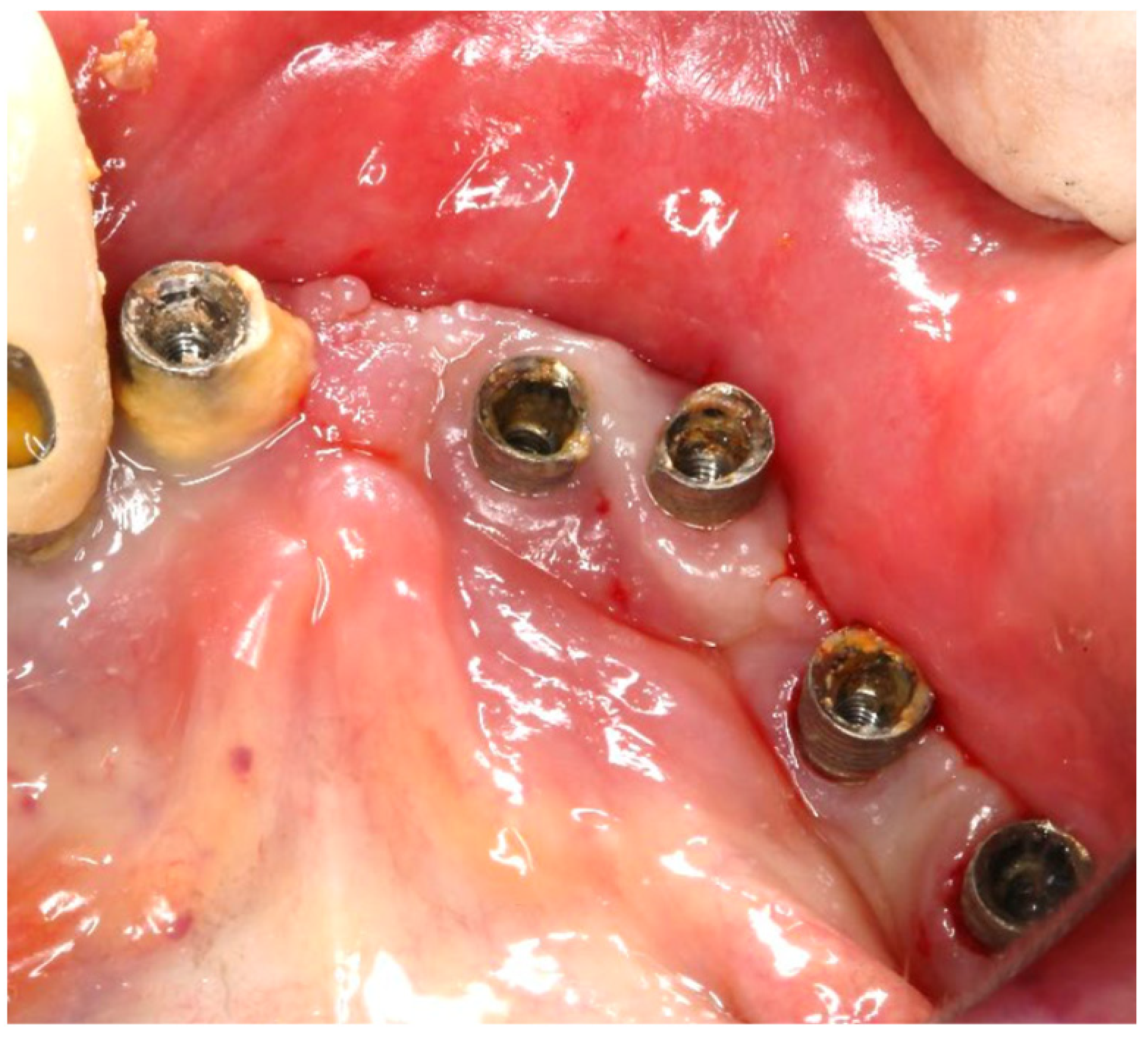 Medicina 61 01094 g020