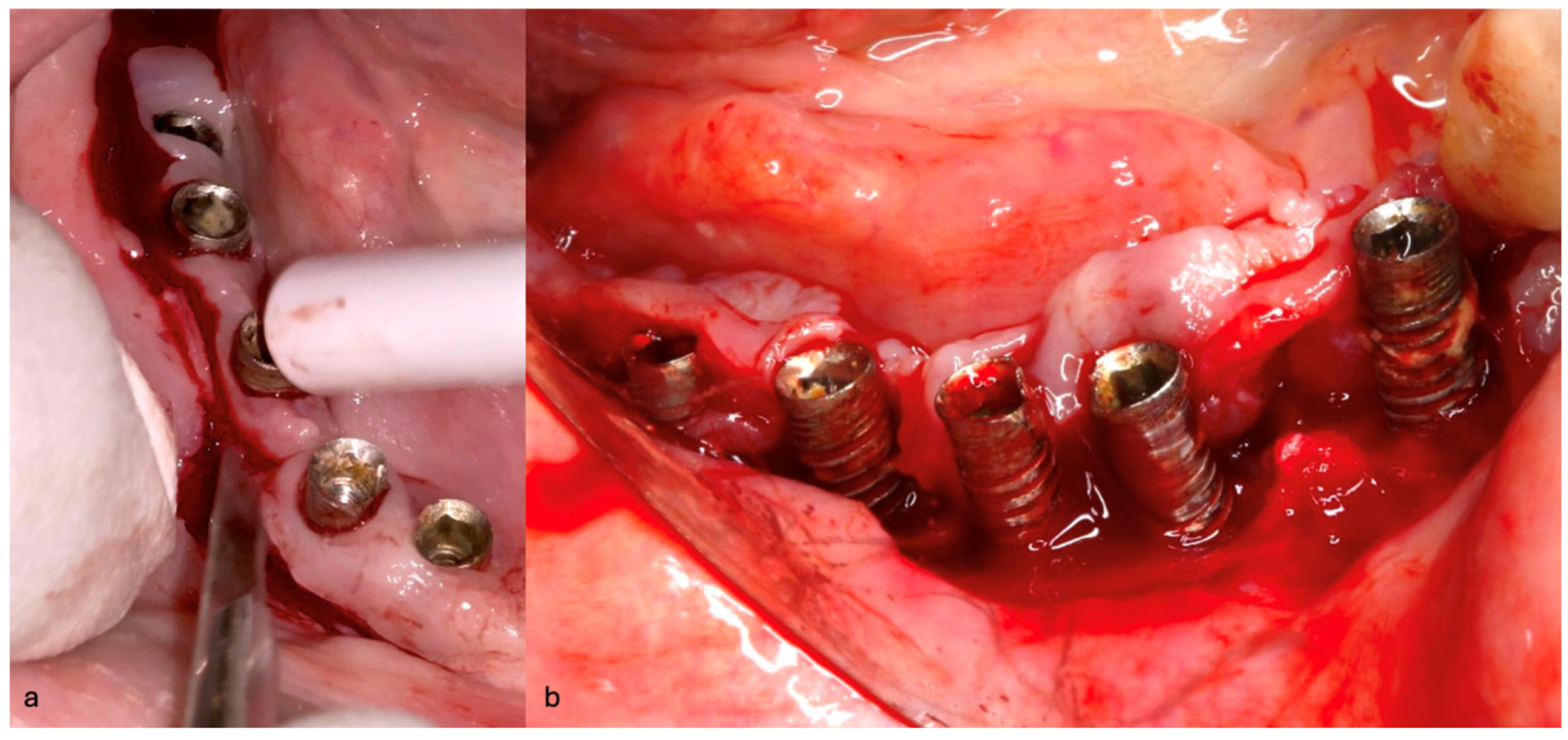 Medicina 61 01094 g021