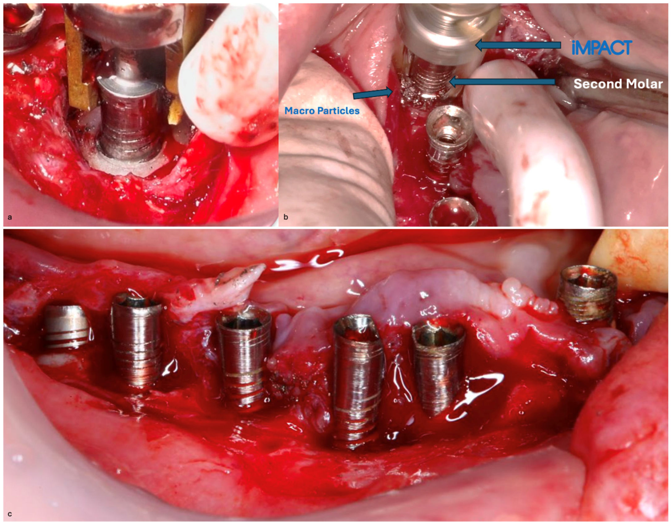 Medicina 61 01094 g022