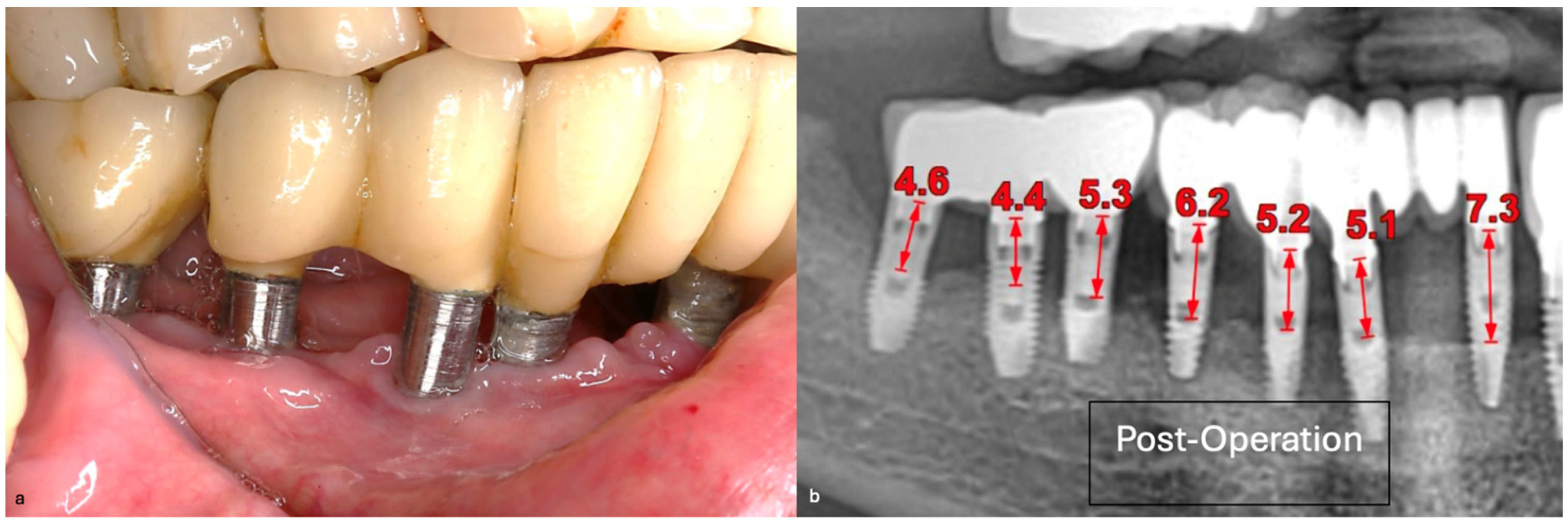 Medicina 61 01094 g024