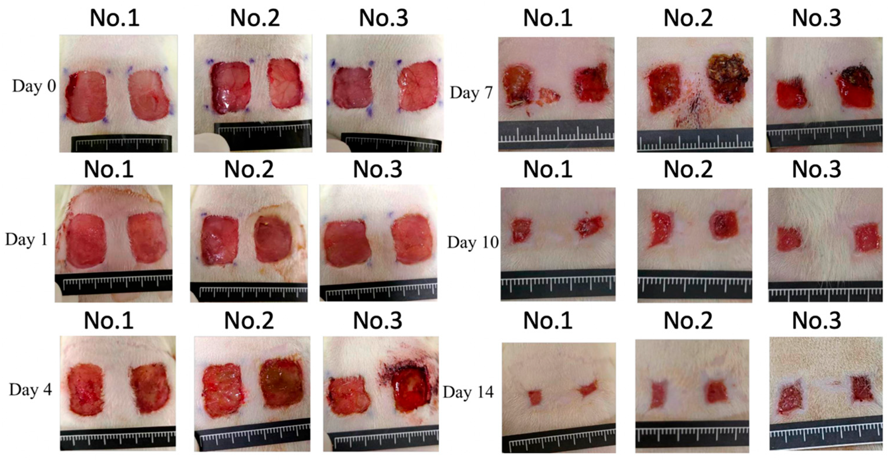 Medicina 61 01098 g002