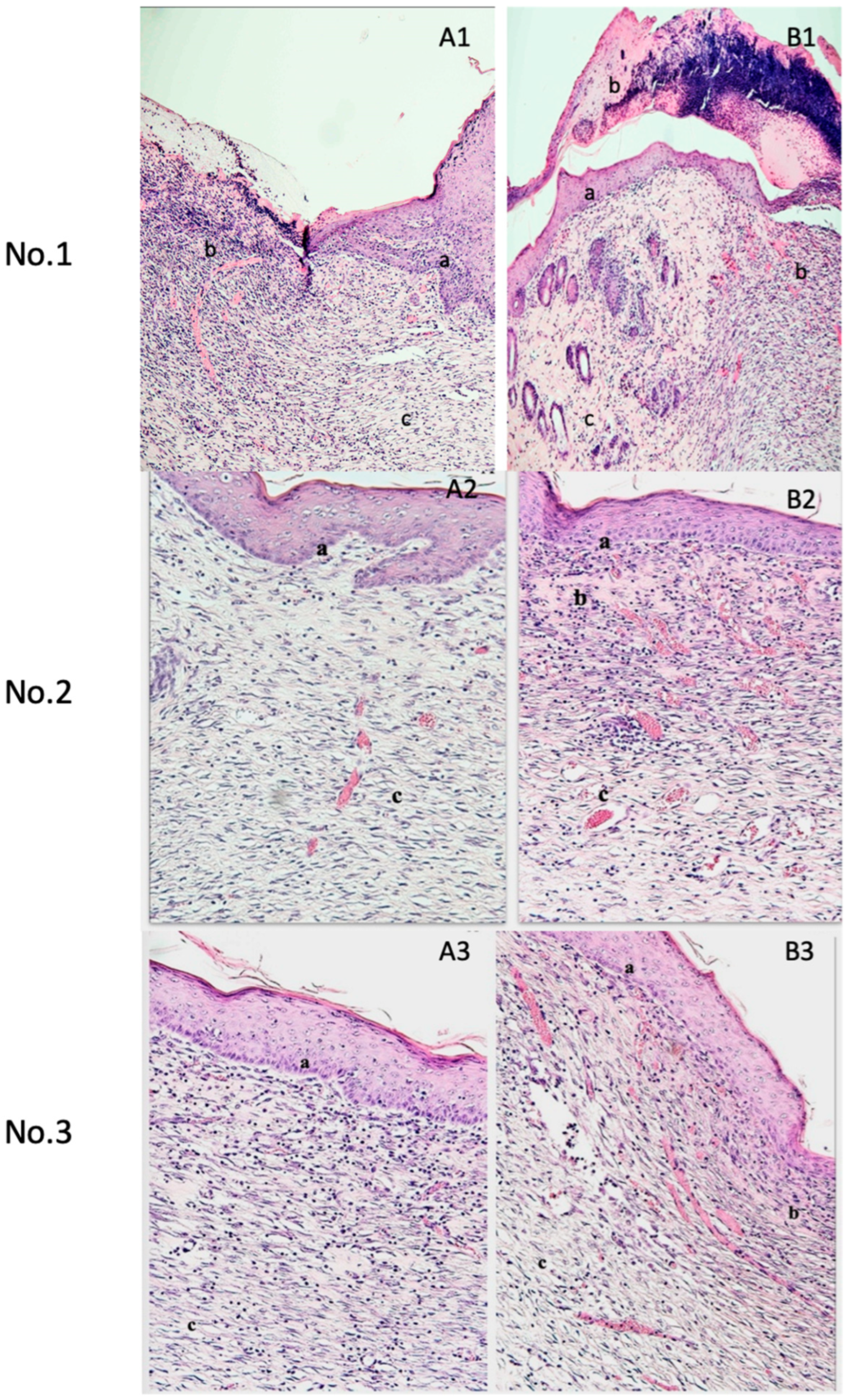 Medicina 61 01098 g003