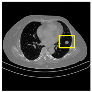 Medicina 61 01126 i001