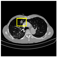 Medicina 61 01126 i011