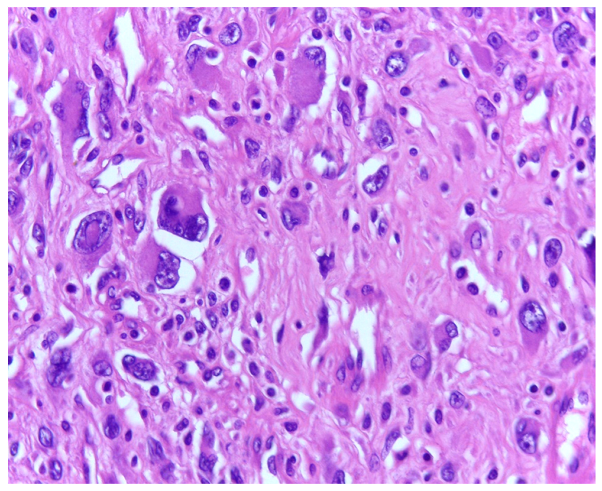 Medicina 61 01431 g003