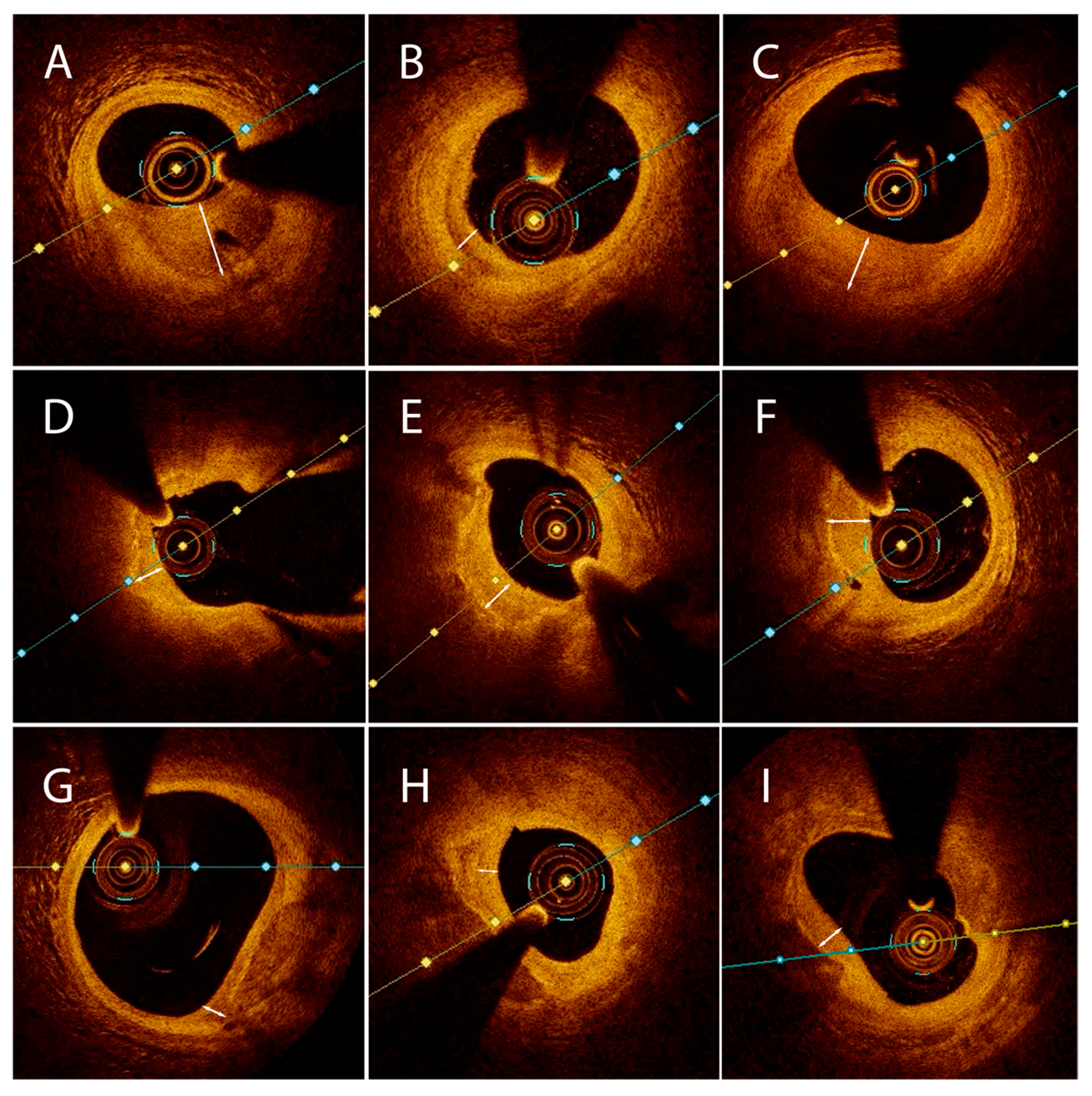 Medicina 61 01440 g002 Medicina 61 01440 g002