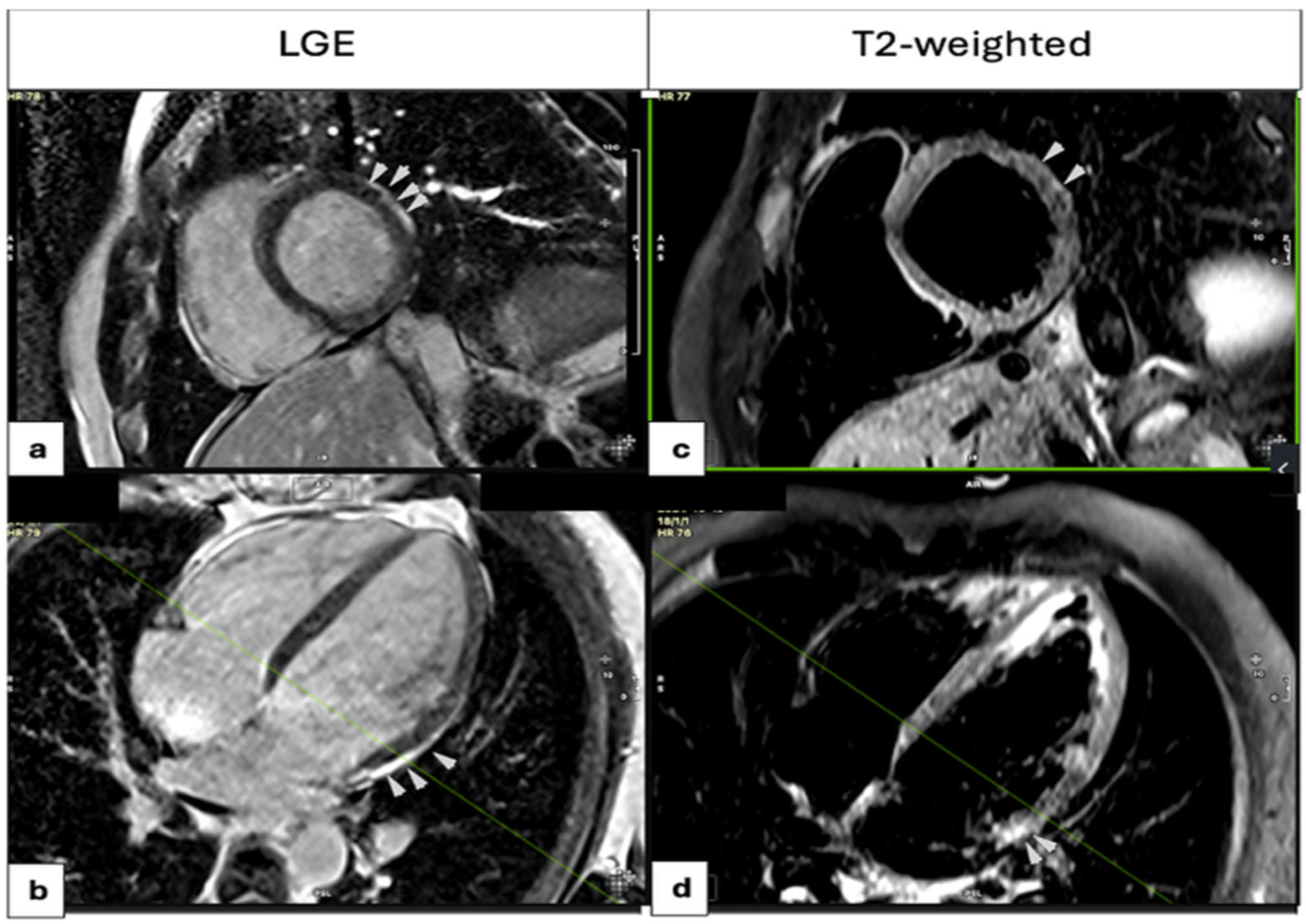 Medicina 61 01444 g003 Medicina 61 01444 g003