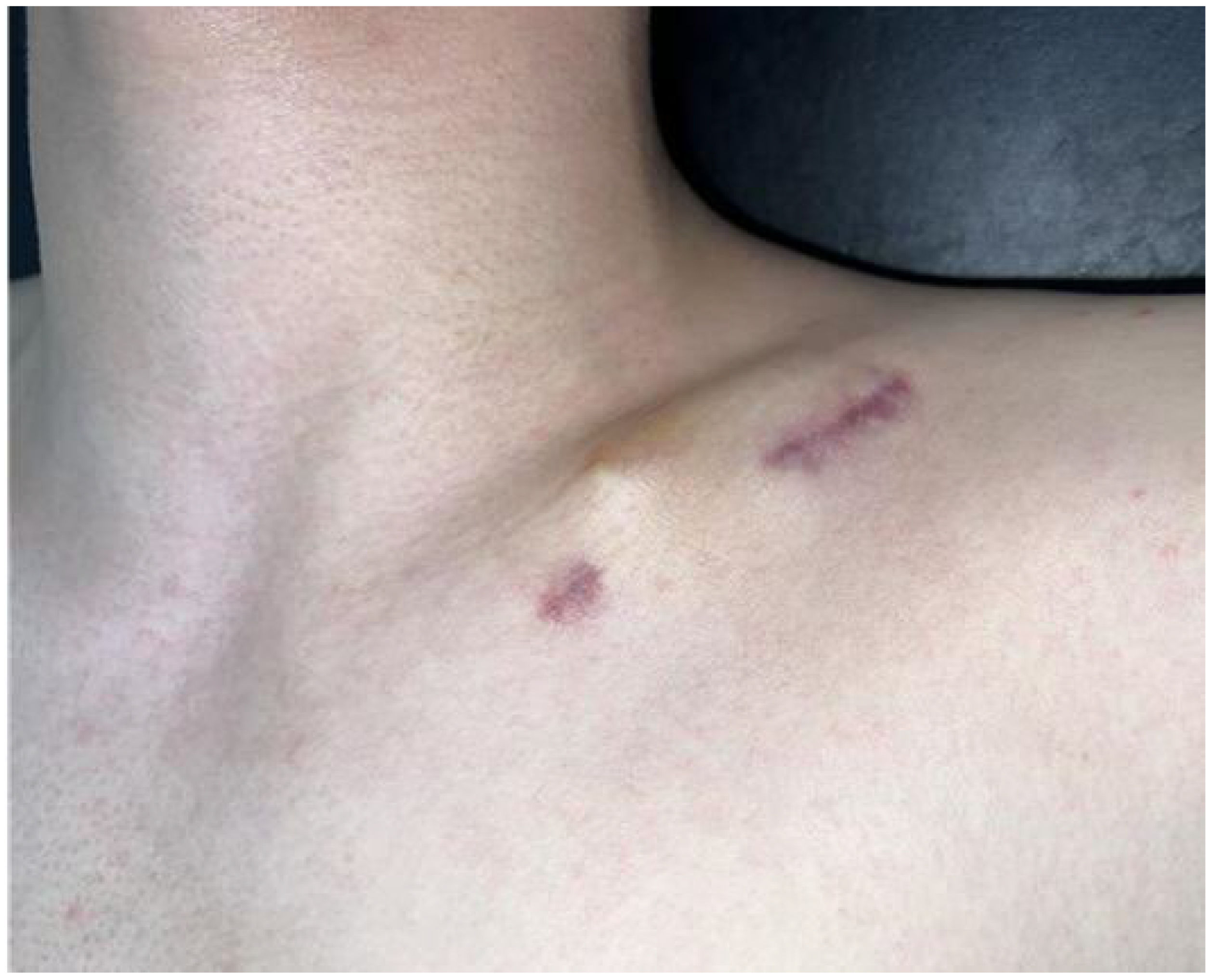 Medicina 61 01494 g003