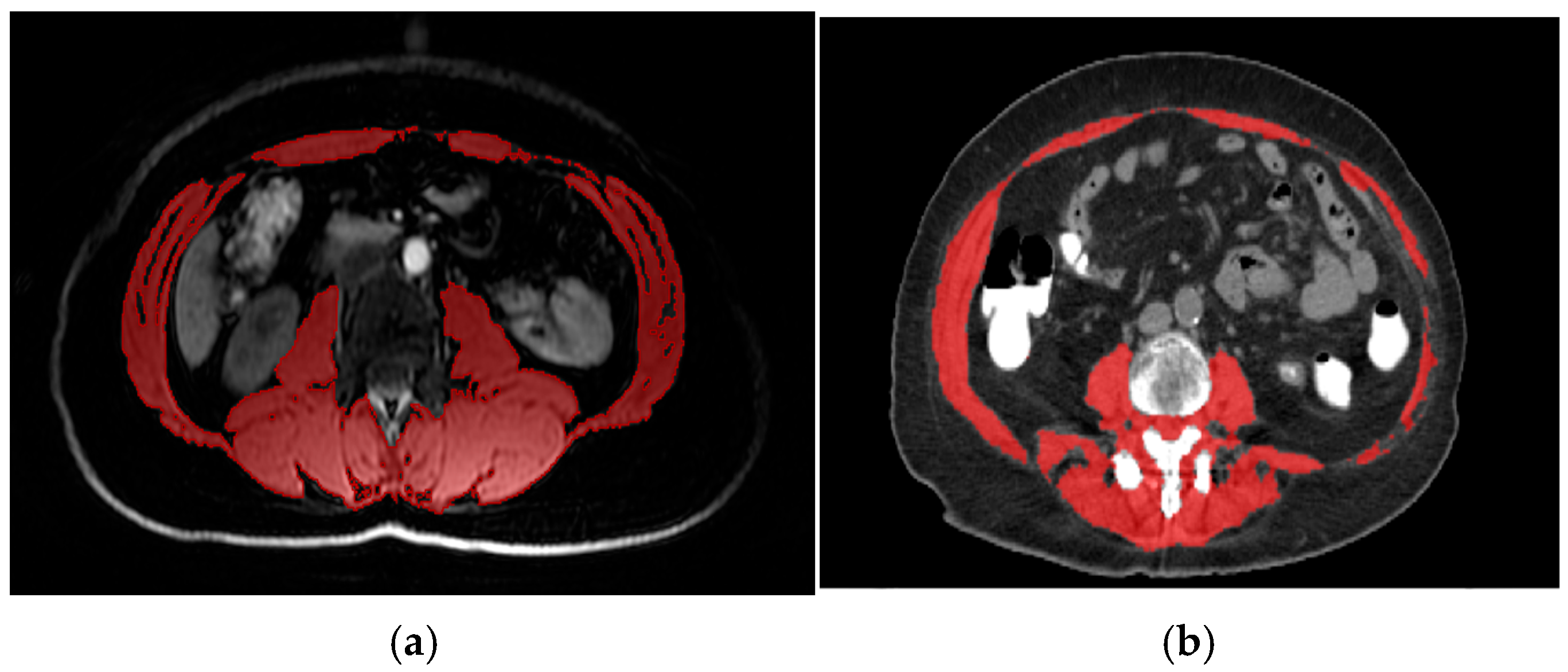 Medicina 61 01508 g001 Medicina 61 01508 g001