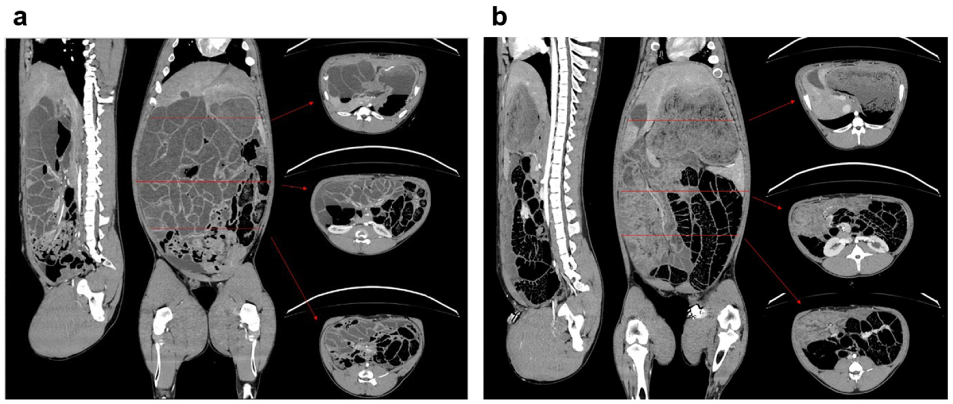 Medicina 61 01523 g002
