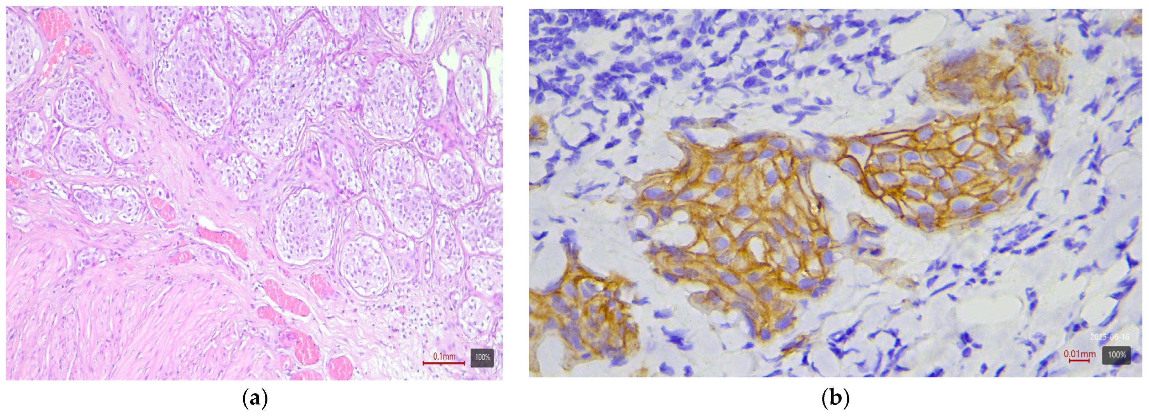 Medicina 61 01759 g004